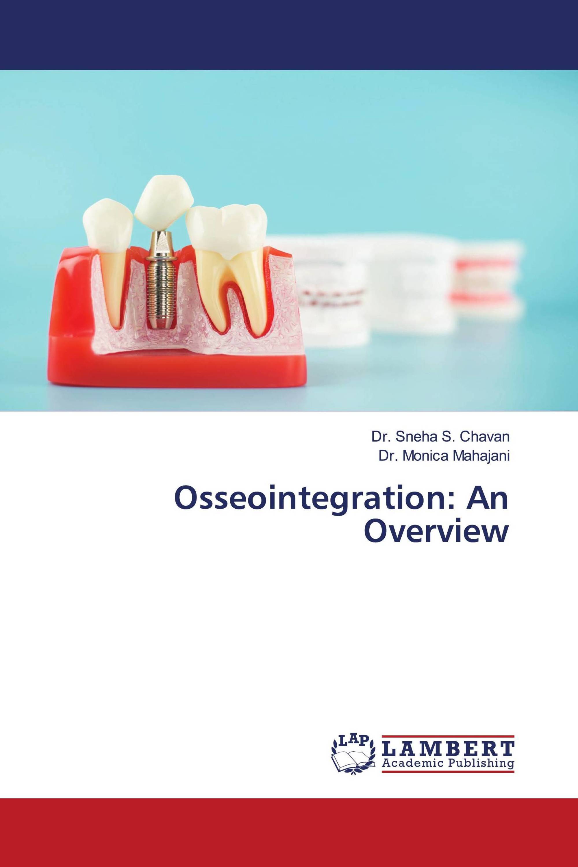 Osseointegration: An Overview / 978-620-6-15639-0 / 9786206156390 ...