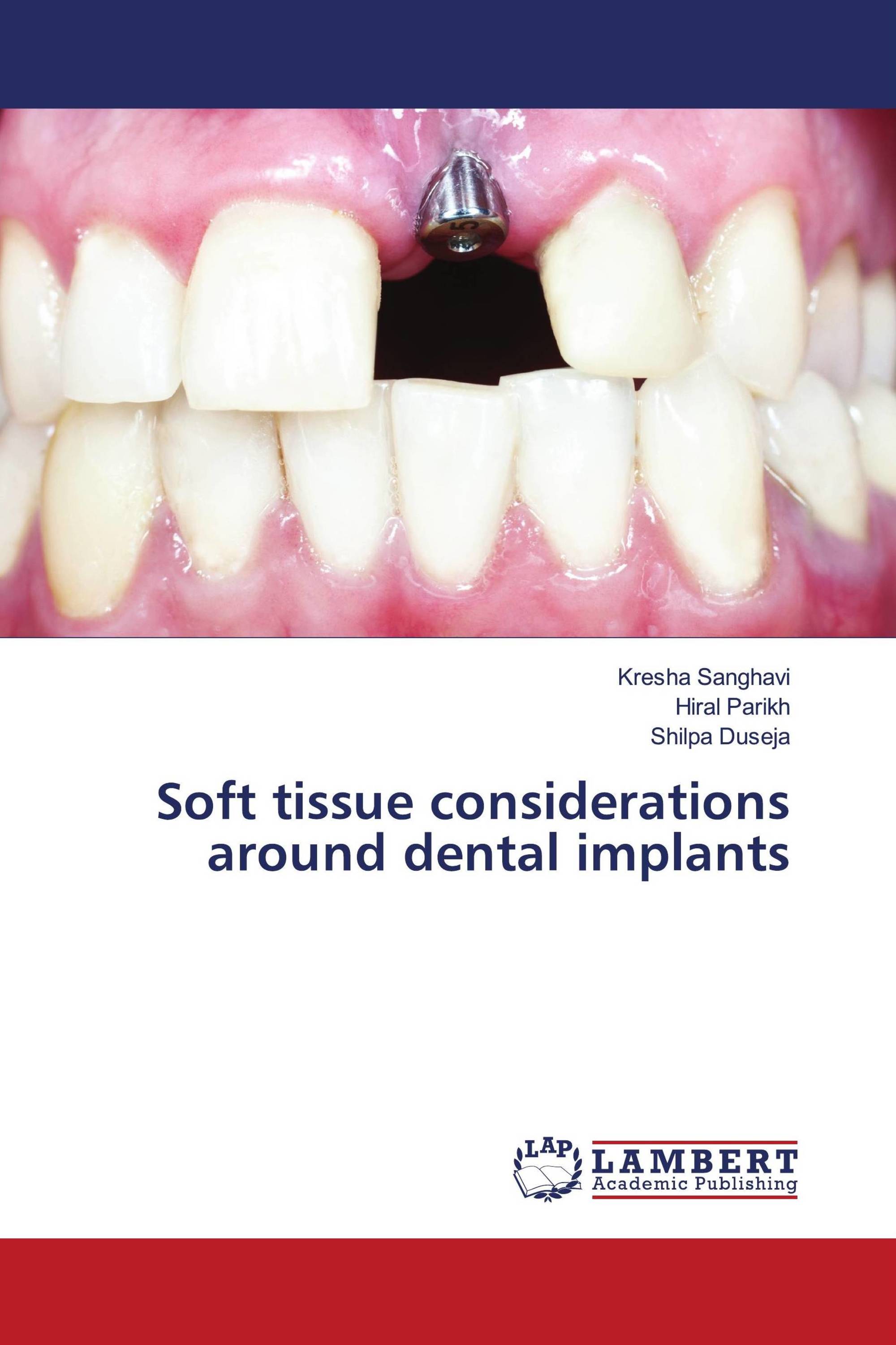 Soft tissue considerations around dental implants