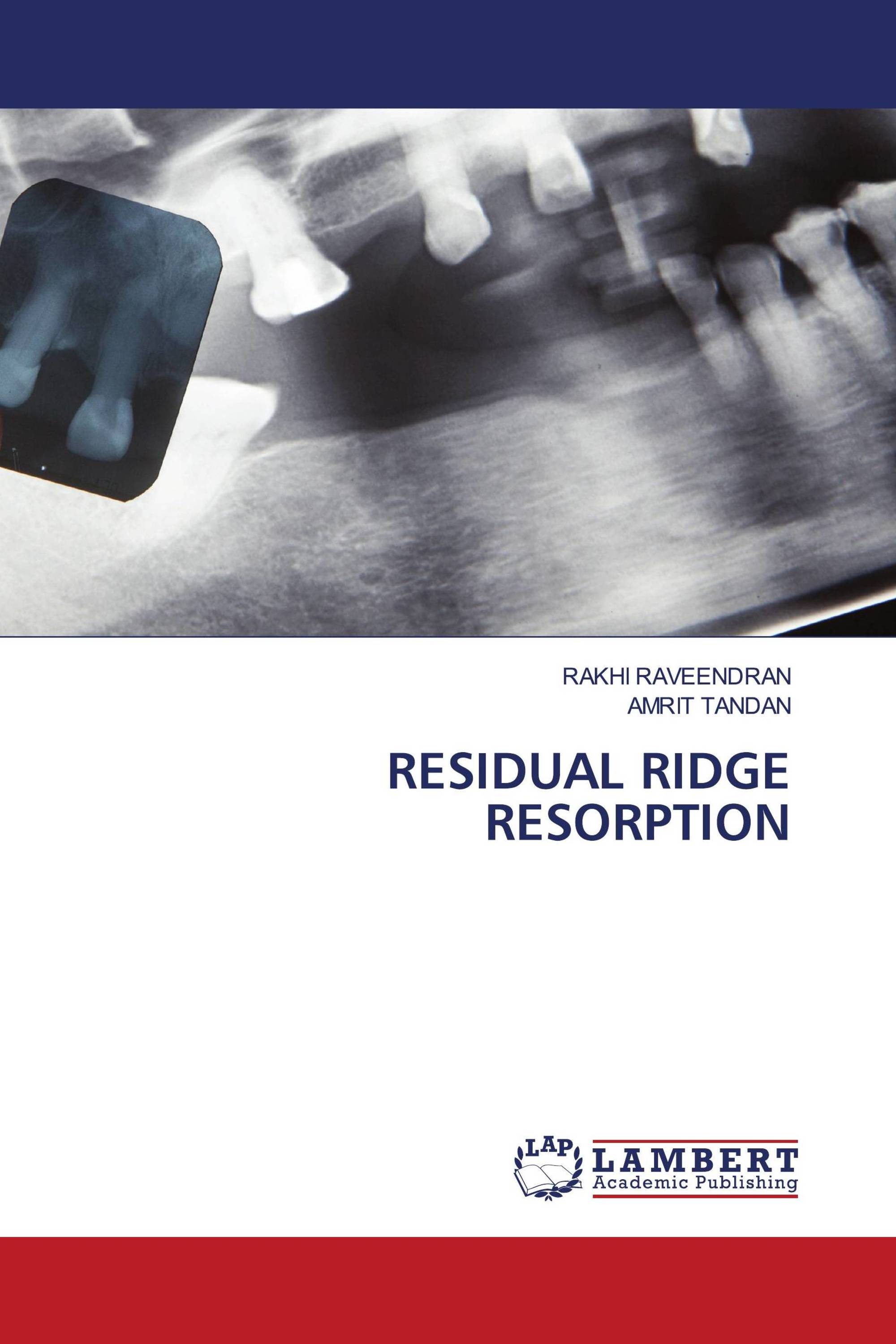 RESIDUAL RIDGE RESORPTION