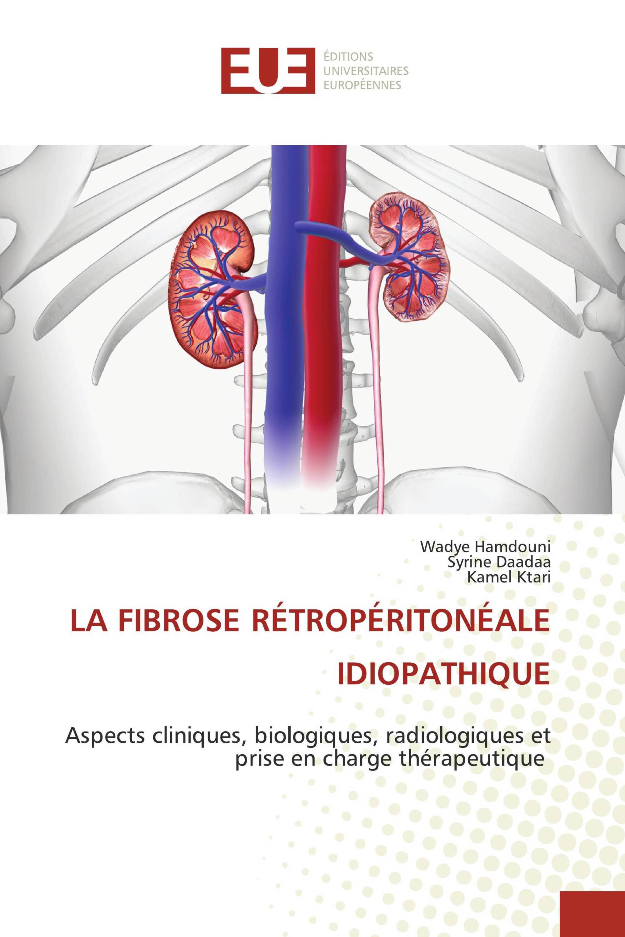 LA FIBROSE RÉTROPÉRITONÉALE IDIOPATHIQUE