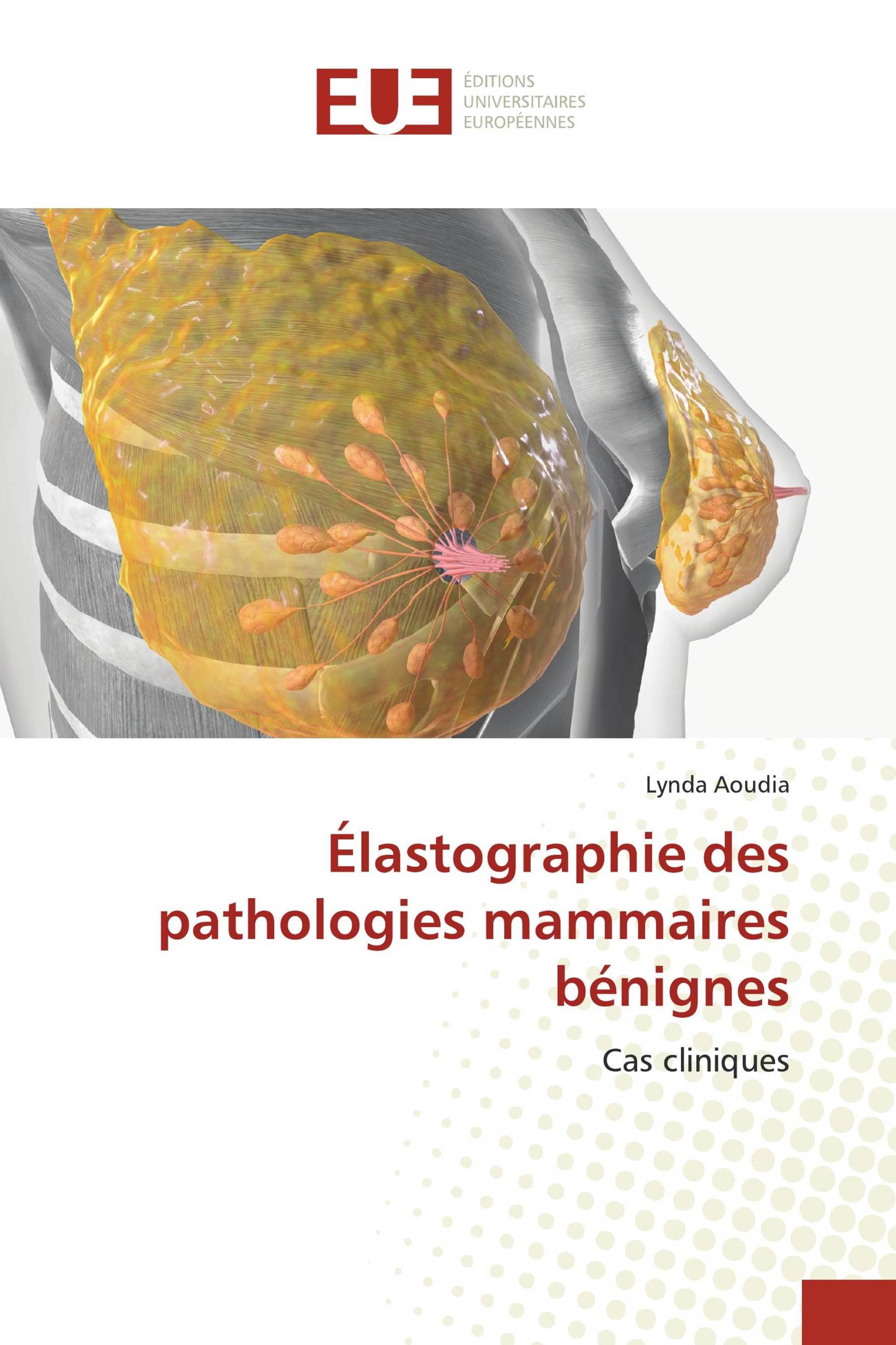 Élastographie des pathologies mammaires bénignes