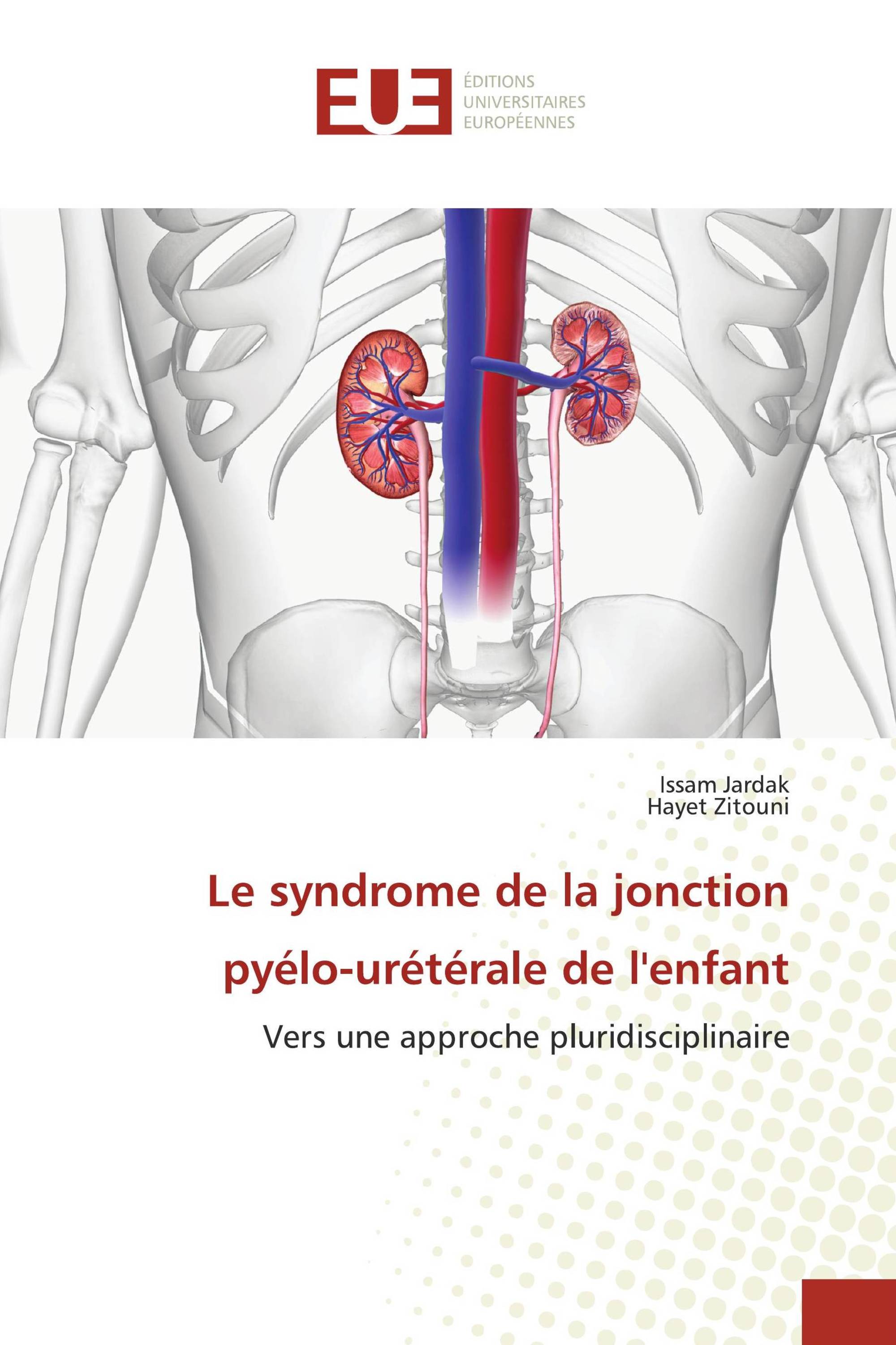 Le syndrome de la jonction pyélo-urétérale de l'enfant