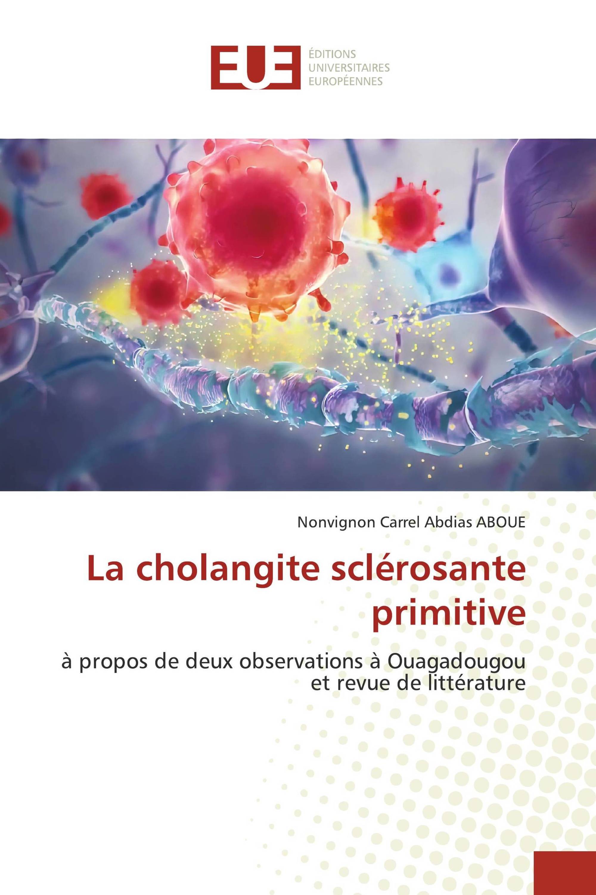 La cholangite sclérosante primitive