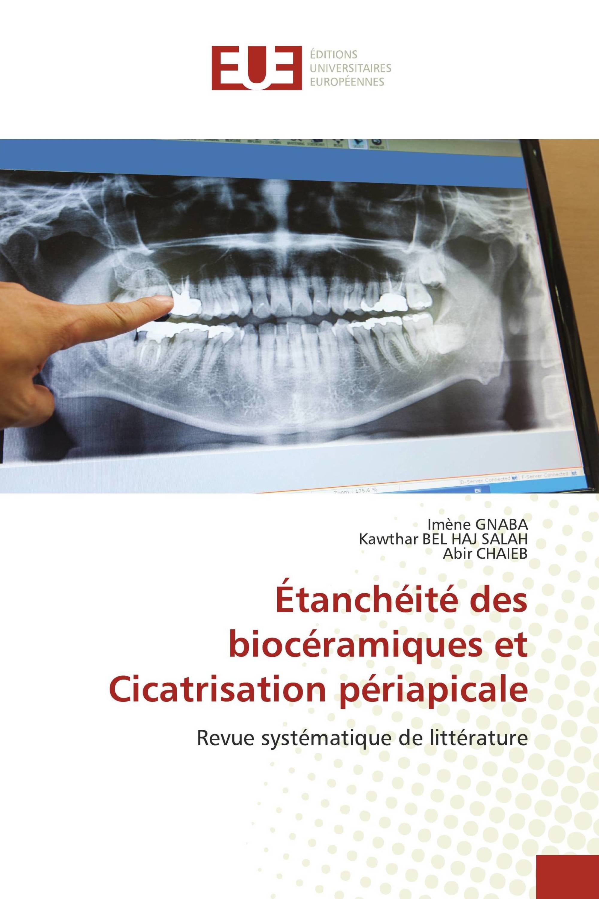 Étanchéité des biocéramiques et Cicatrisation périapicale