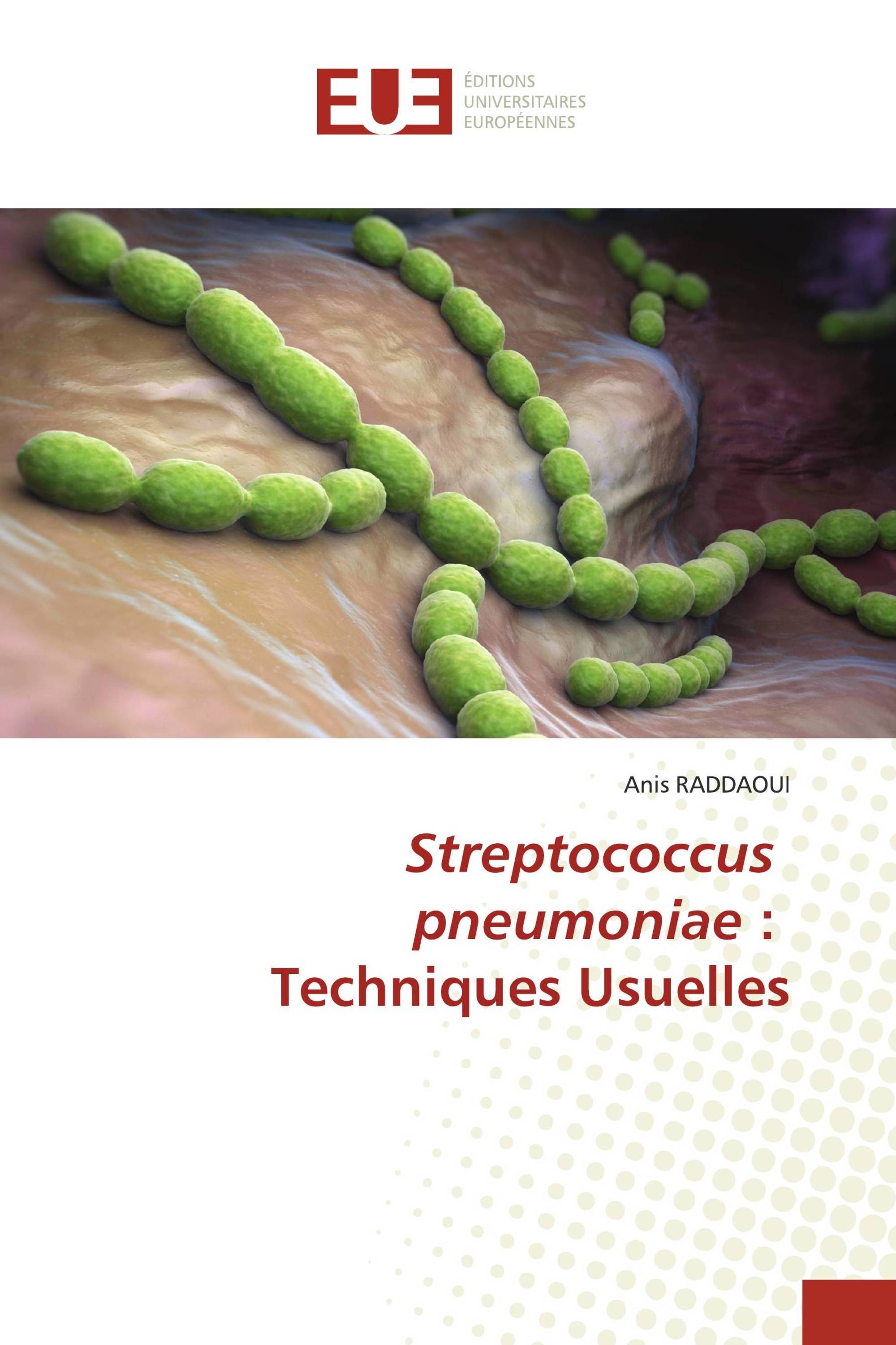 Streptococcus pneumoniae : Techniques Usuelles