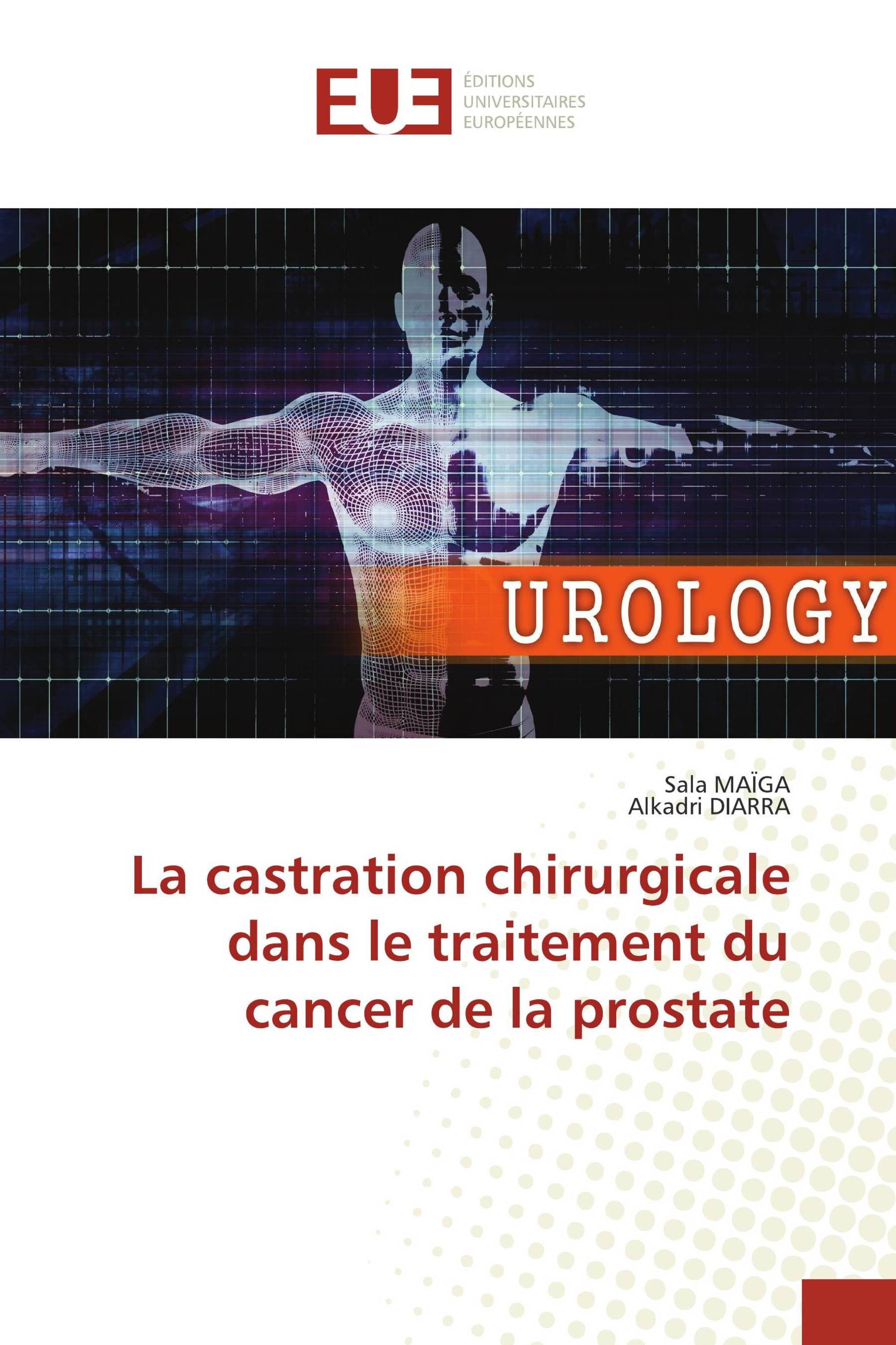 La castration chirurgicale dans le traitement du cancer de la prostate