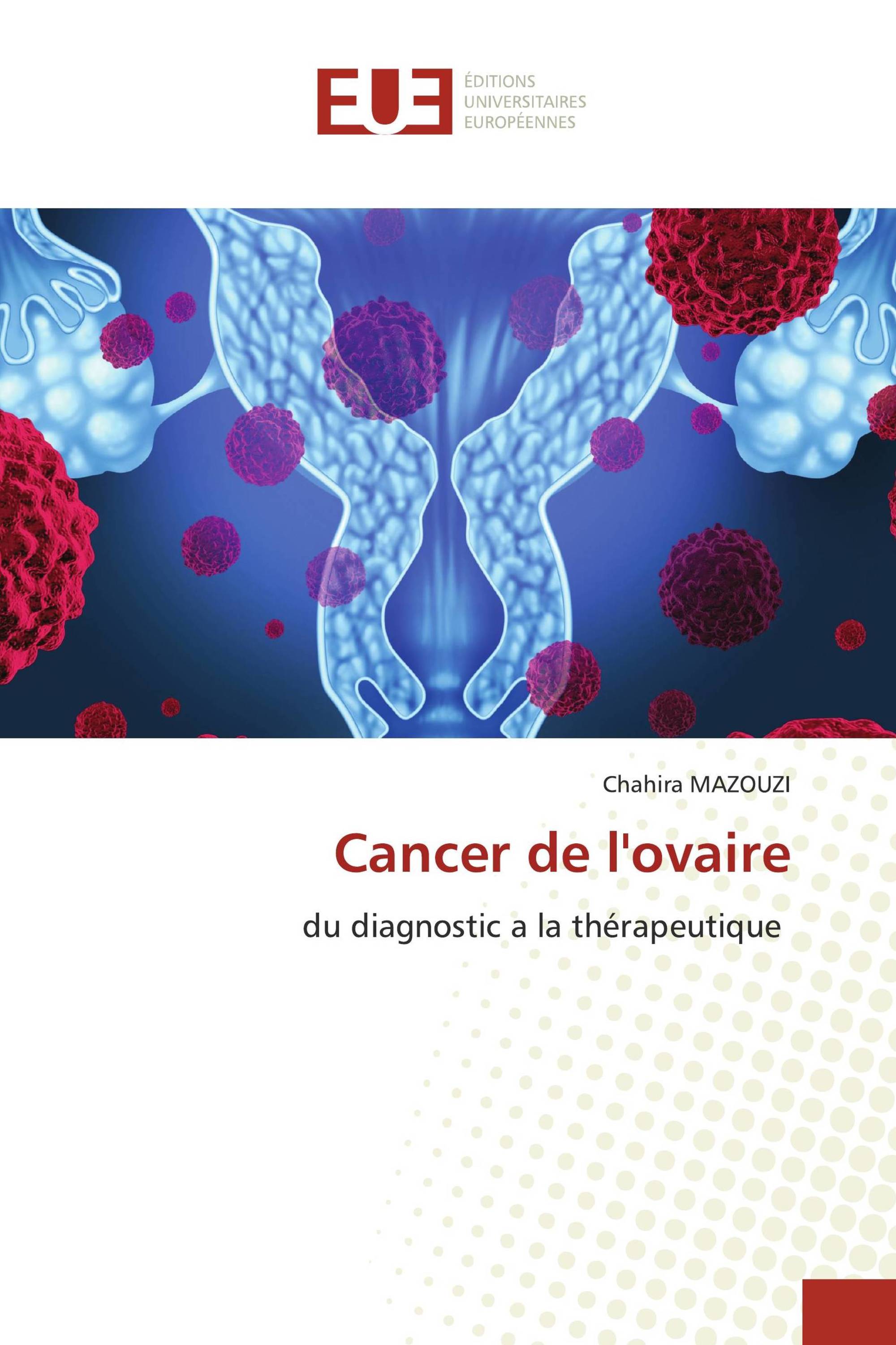 Cancer de l'ovaire