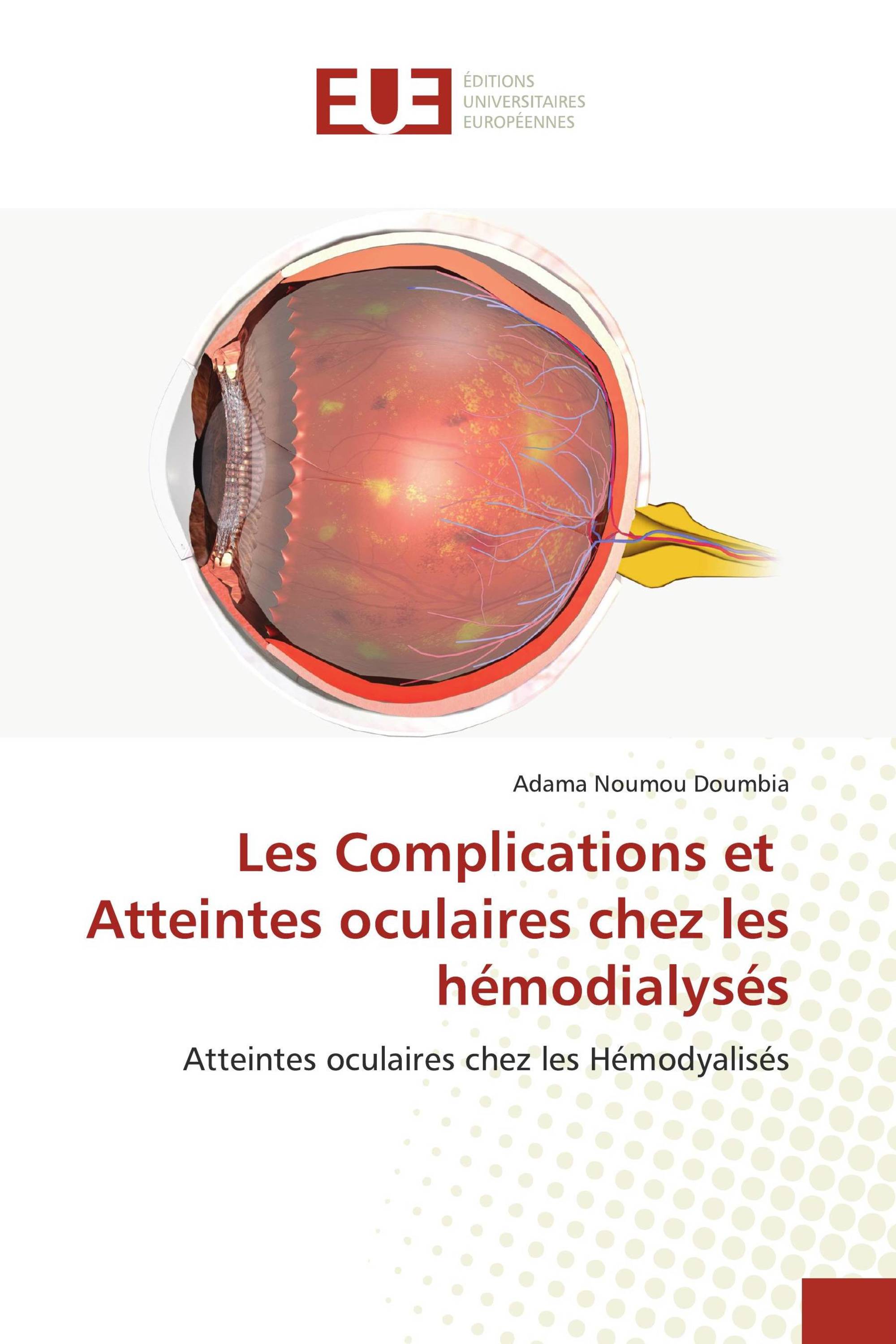 Les Complications et Atteintes oculaires chez les hémodialysés