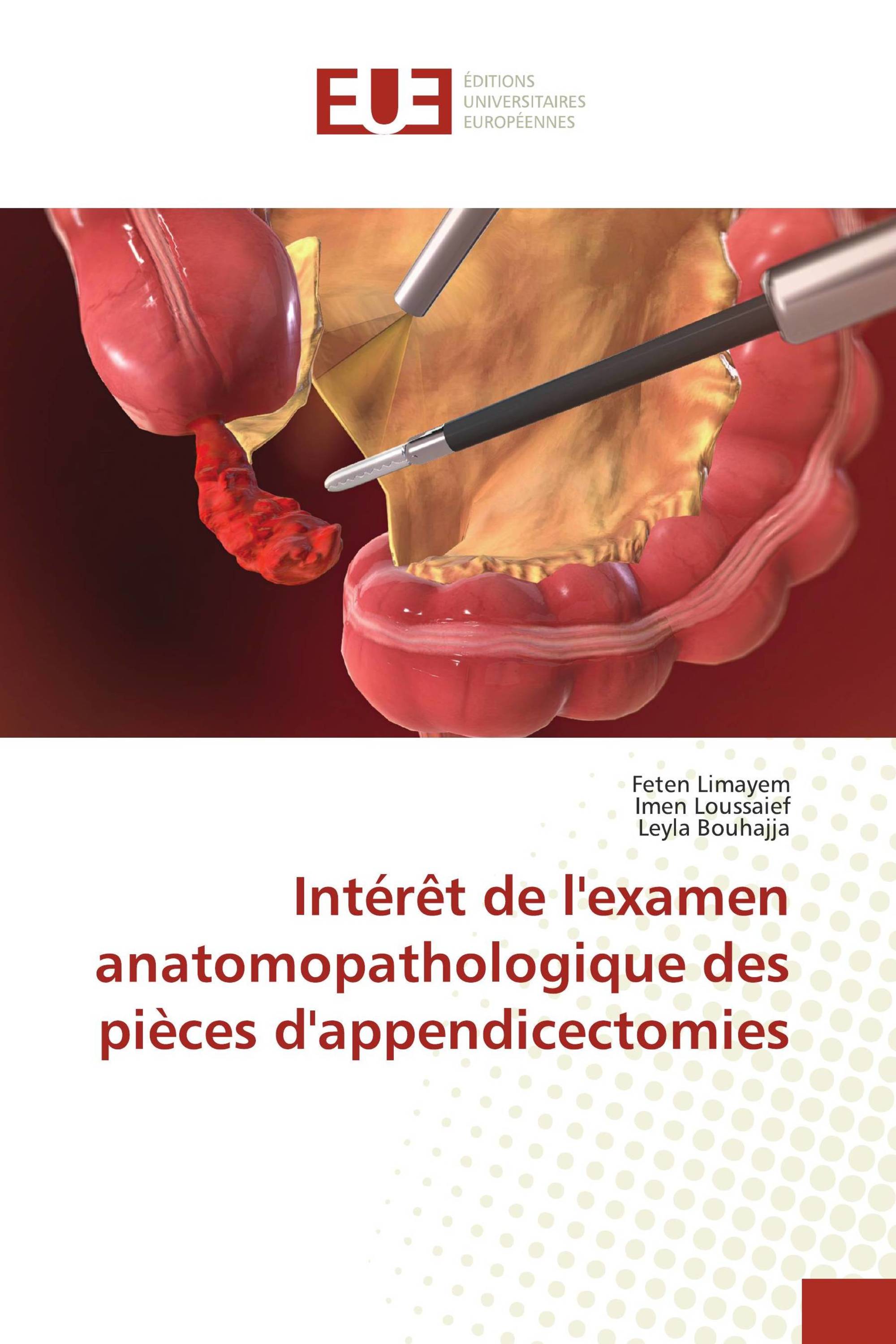 Intérêt de l'examen anatomopathologique des pièces d'appendicectomies