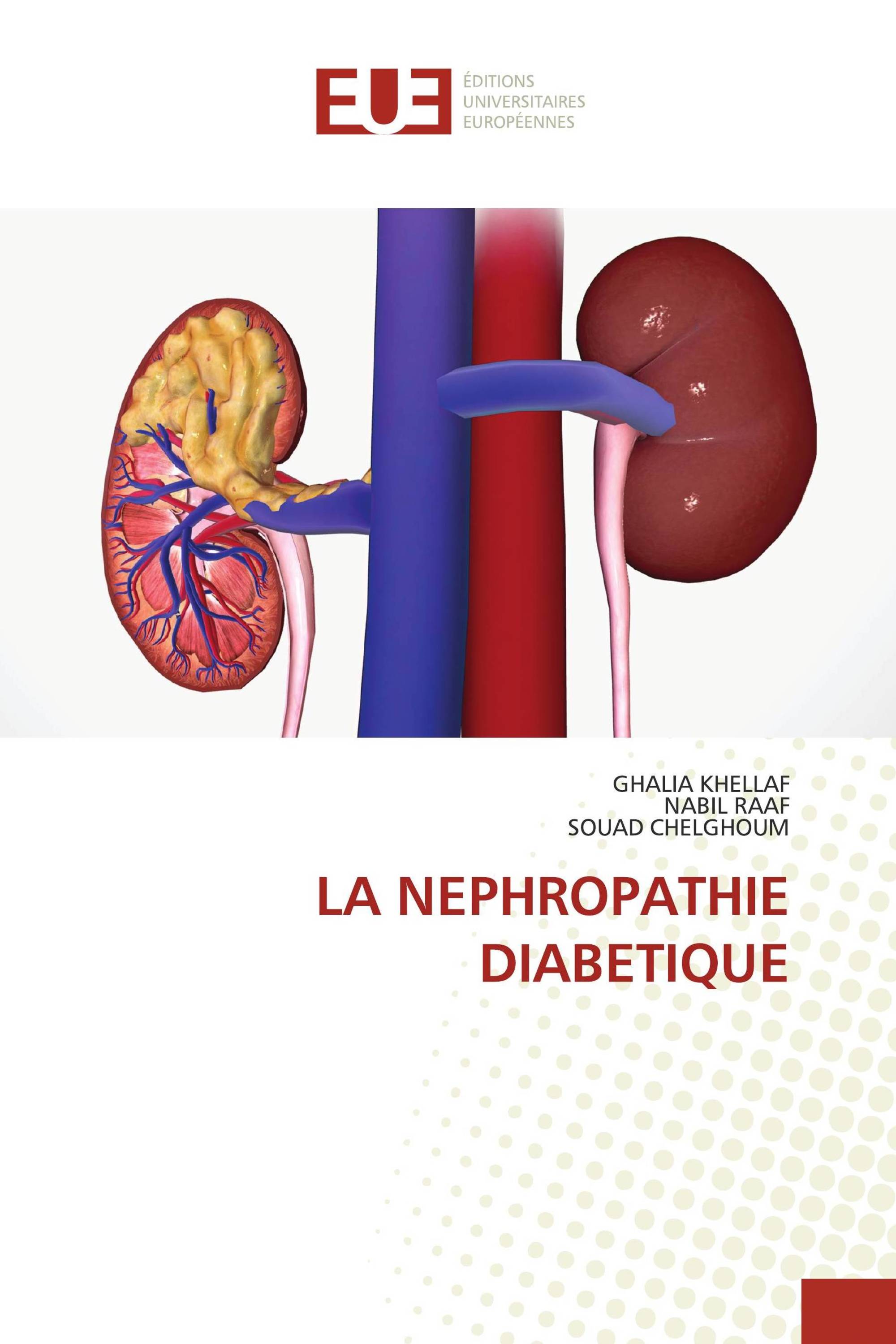 LA NEPHROPATHIE DIABETIQUE