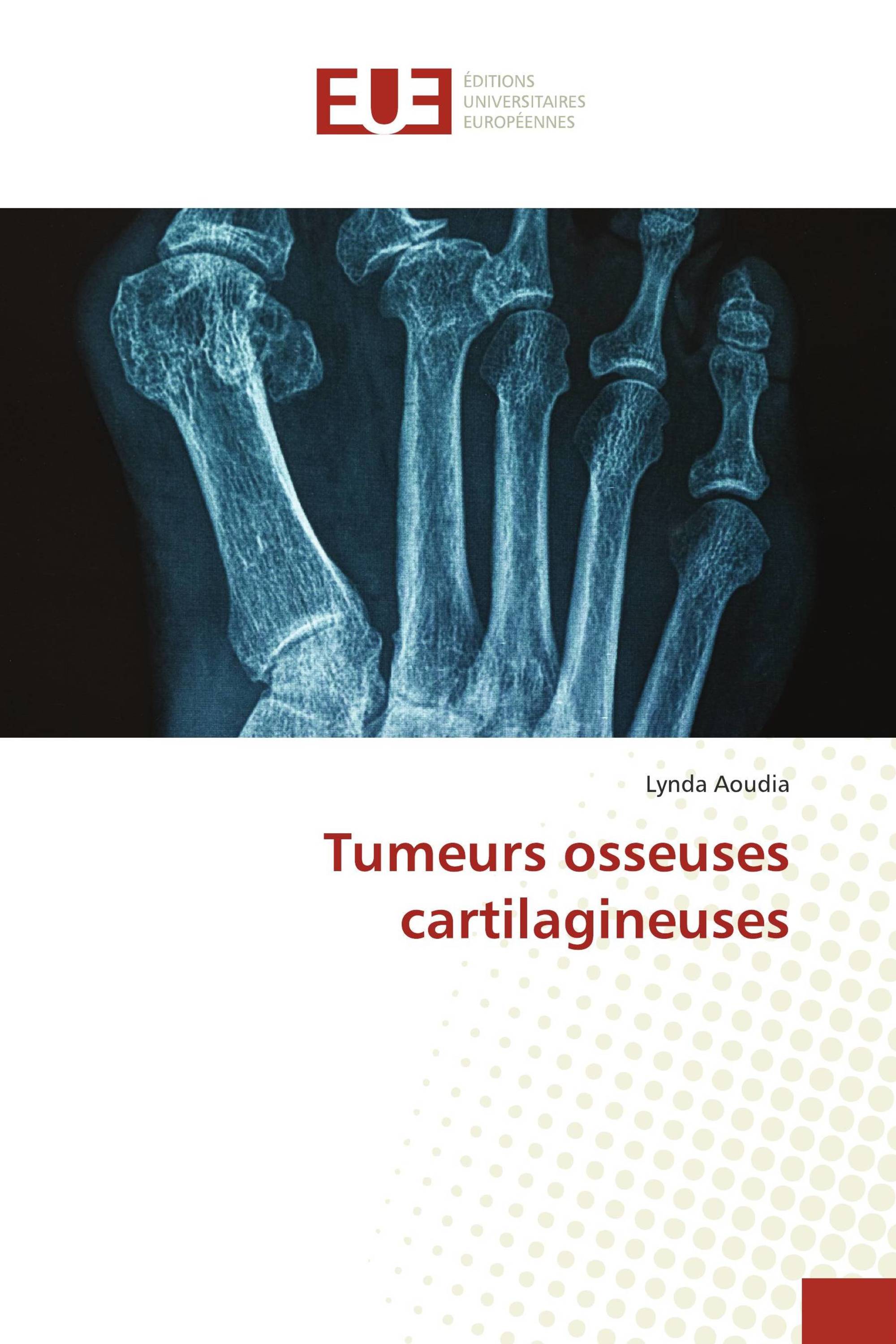 Tumeurs osseuses cartilagineuses