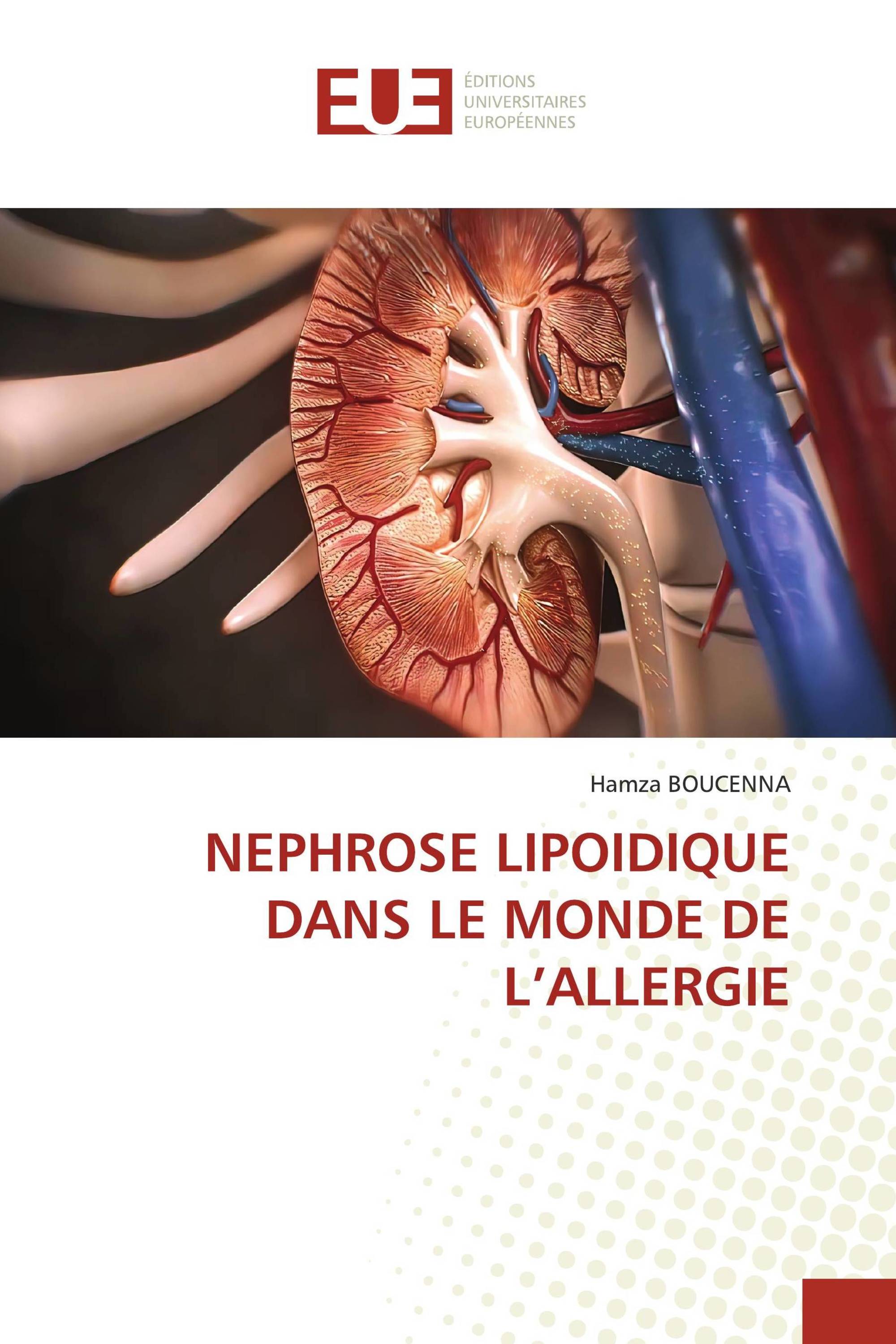 NEPHROSE LIPOIDIQUE DANS LE MONDE DE L’ALLERGIE