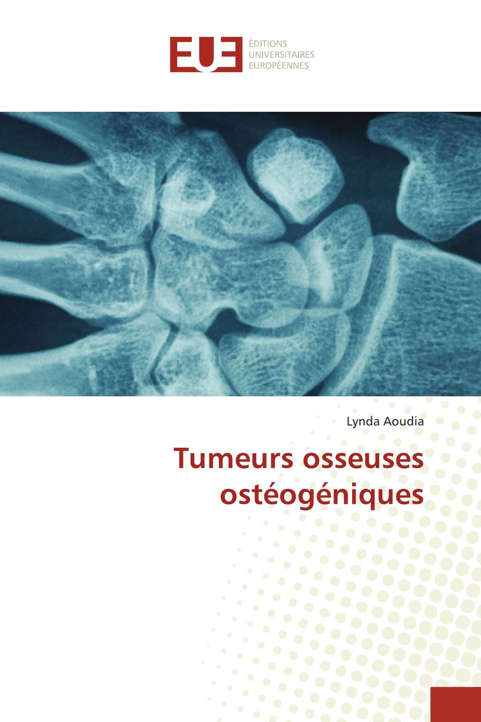 Tumeurs osseuses ostéogéniques