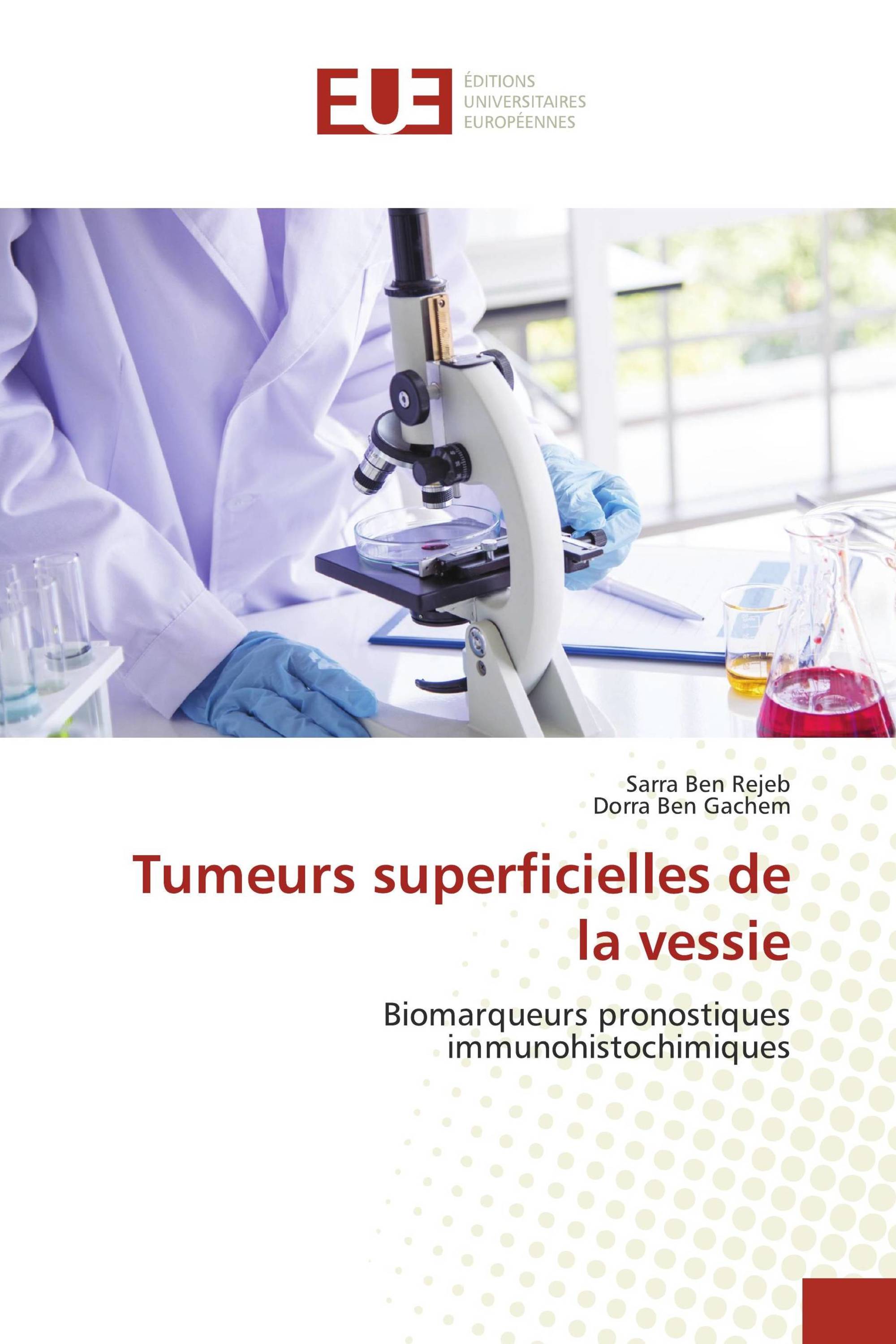 Tumeurs superficielles de la vessie