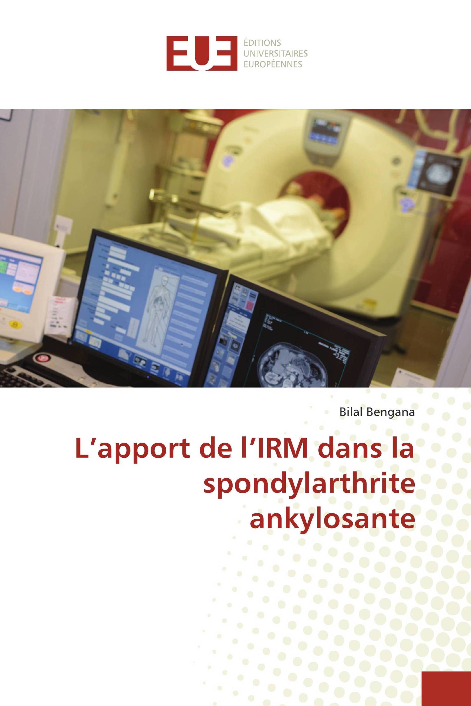 L’apport de l’IRM dans la spondylarthrite ankylosante