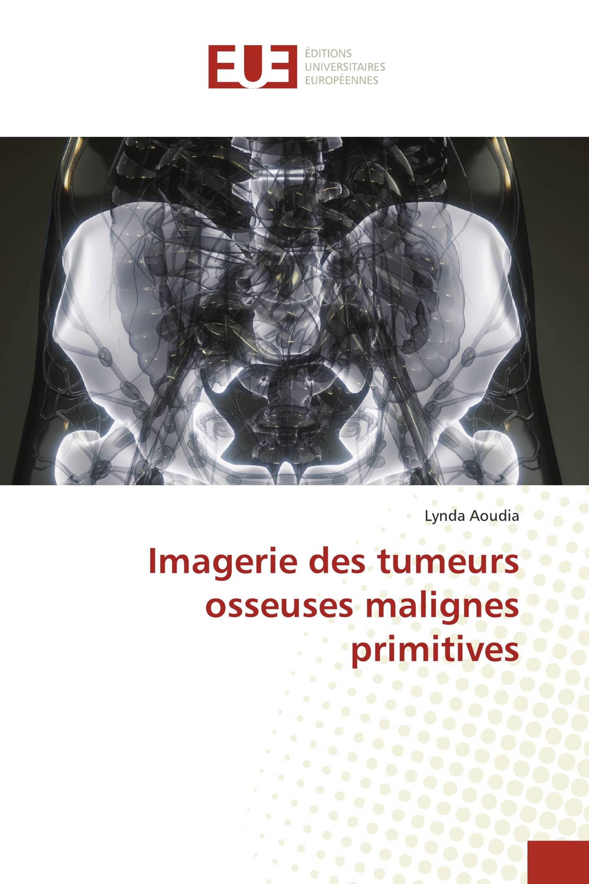 Imagerie des tumeurs osseuses malignes primitives