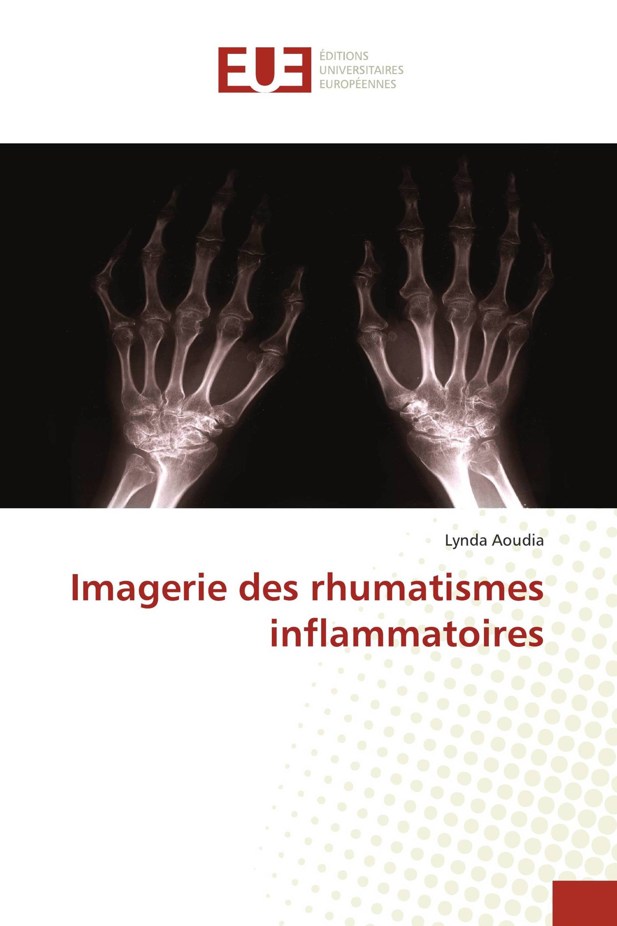 Imagerie des rhumatismes inflammatoires