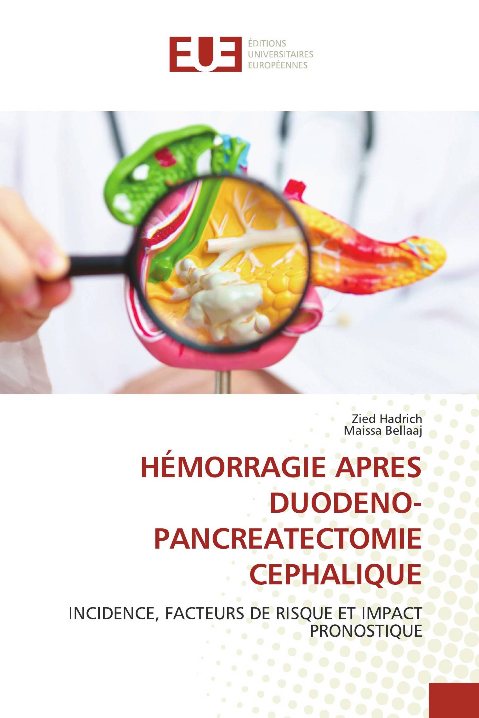 HÉMORRAGIE APRES DUODENO-PANCREATECTOMIE CEPHALIQUE