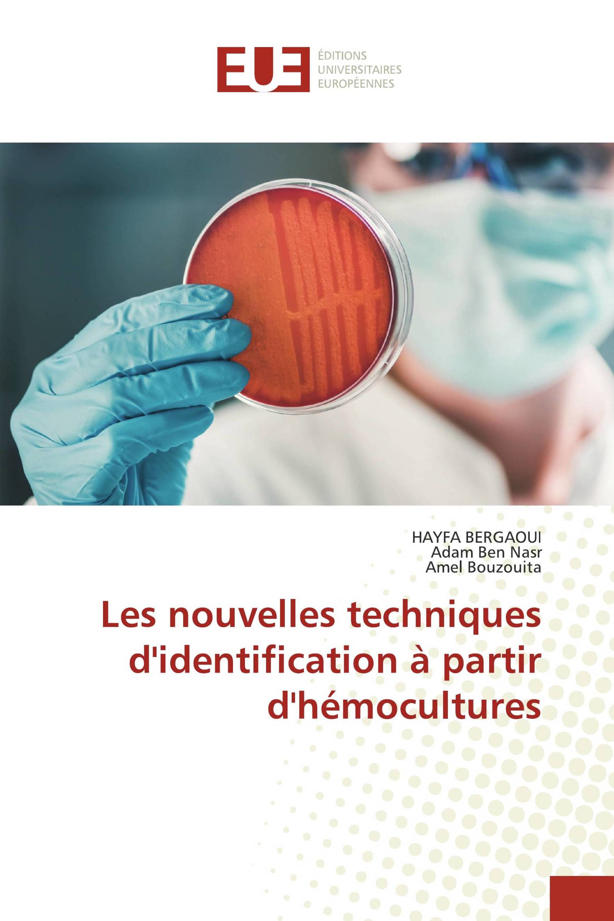 Les nouvelles techniques d'identification à partir d'hémocultures