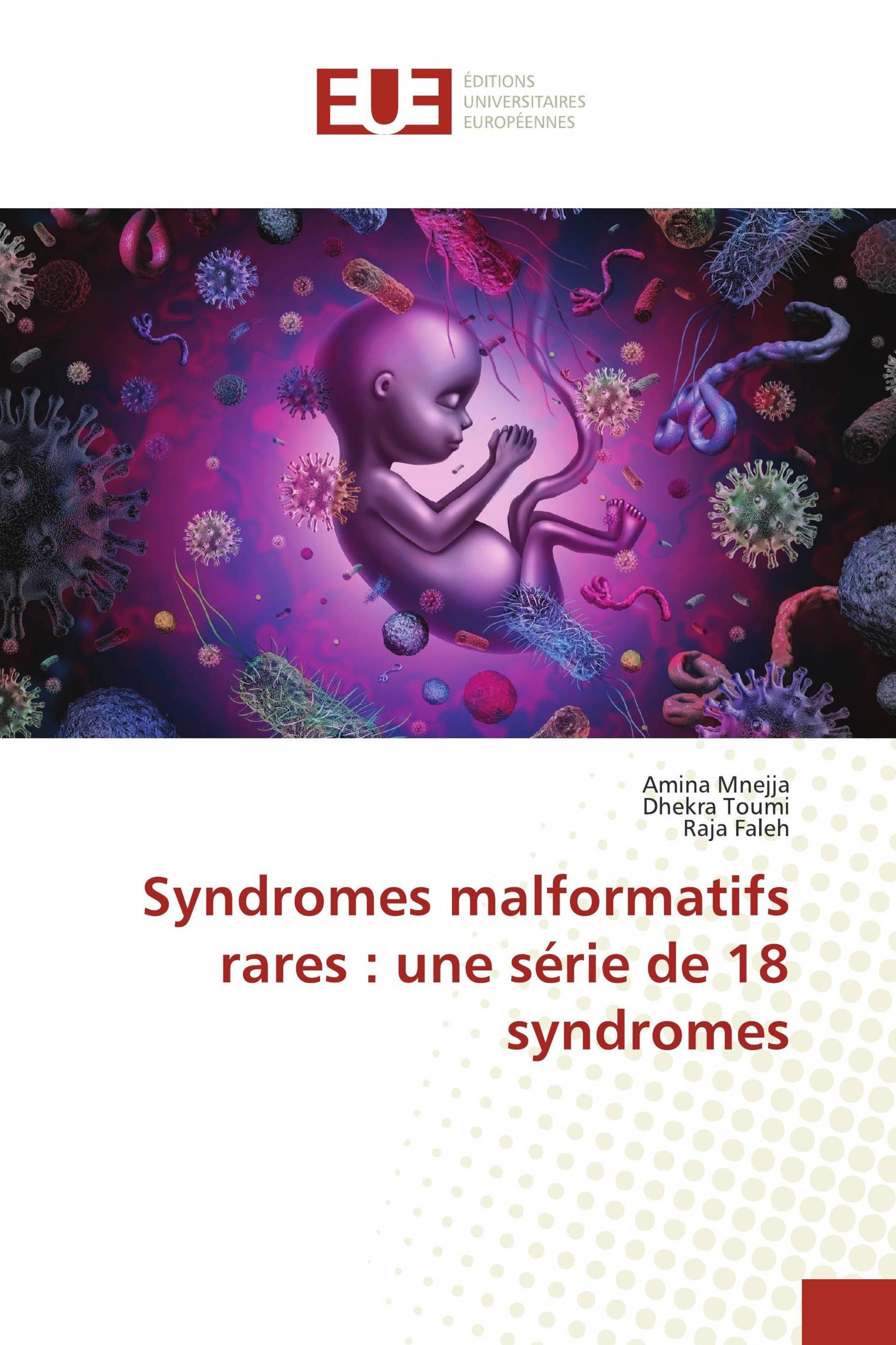 Syndromes malformatifs rares : une série de 18 syndromes