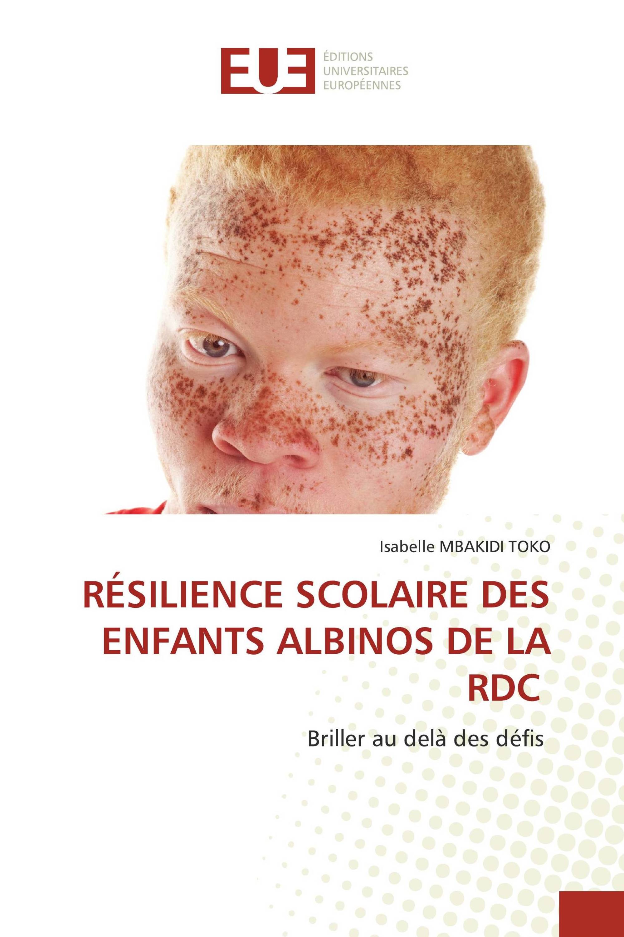 RÉSILIENCE SCOLAIRE DES ENFANTS ALBINOS DE LA RDC