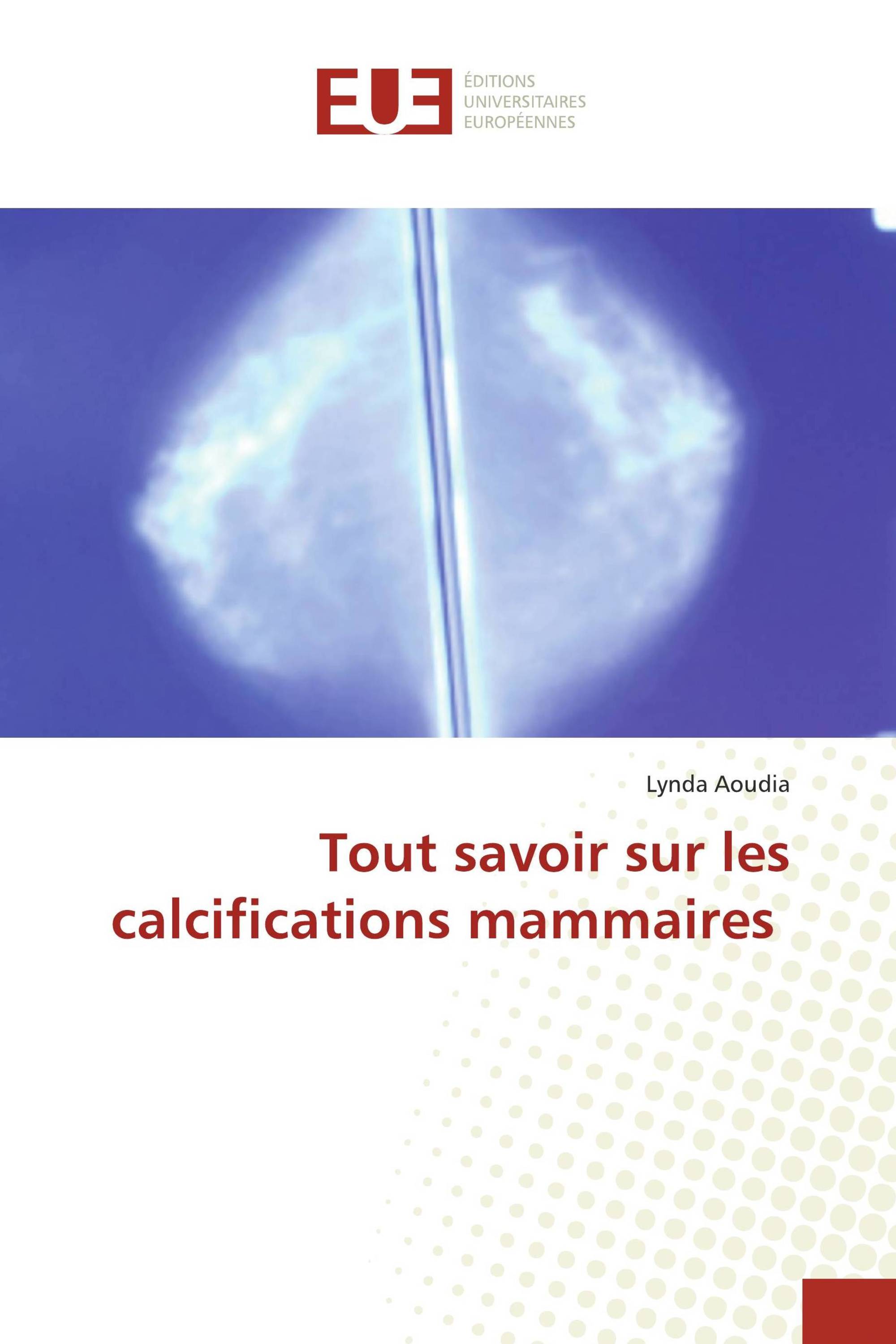 Tout savoir sur les calcifications mammaires