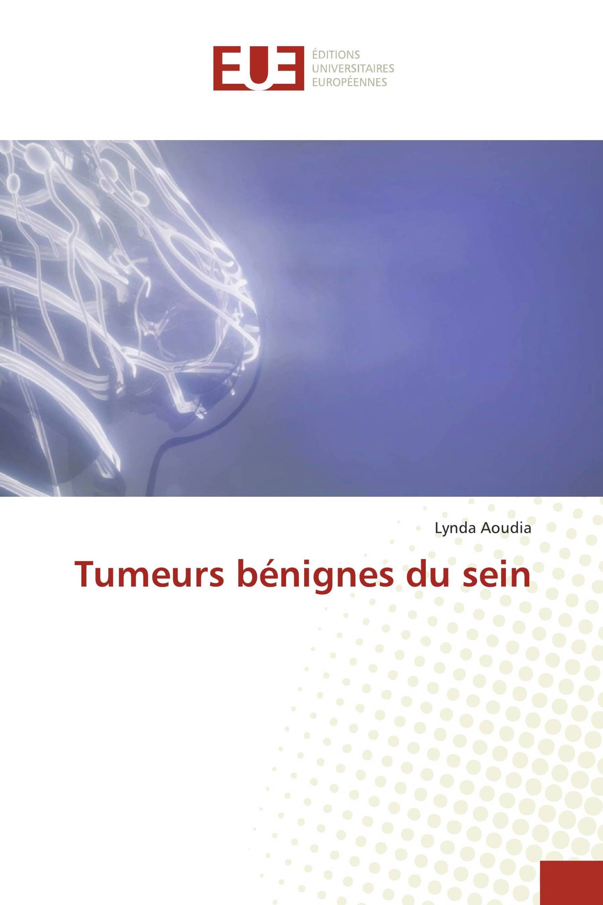 Tumeurs bénignes du sein