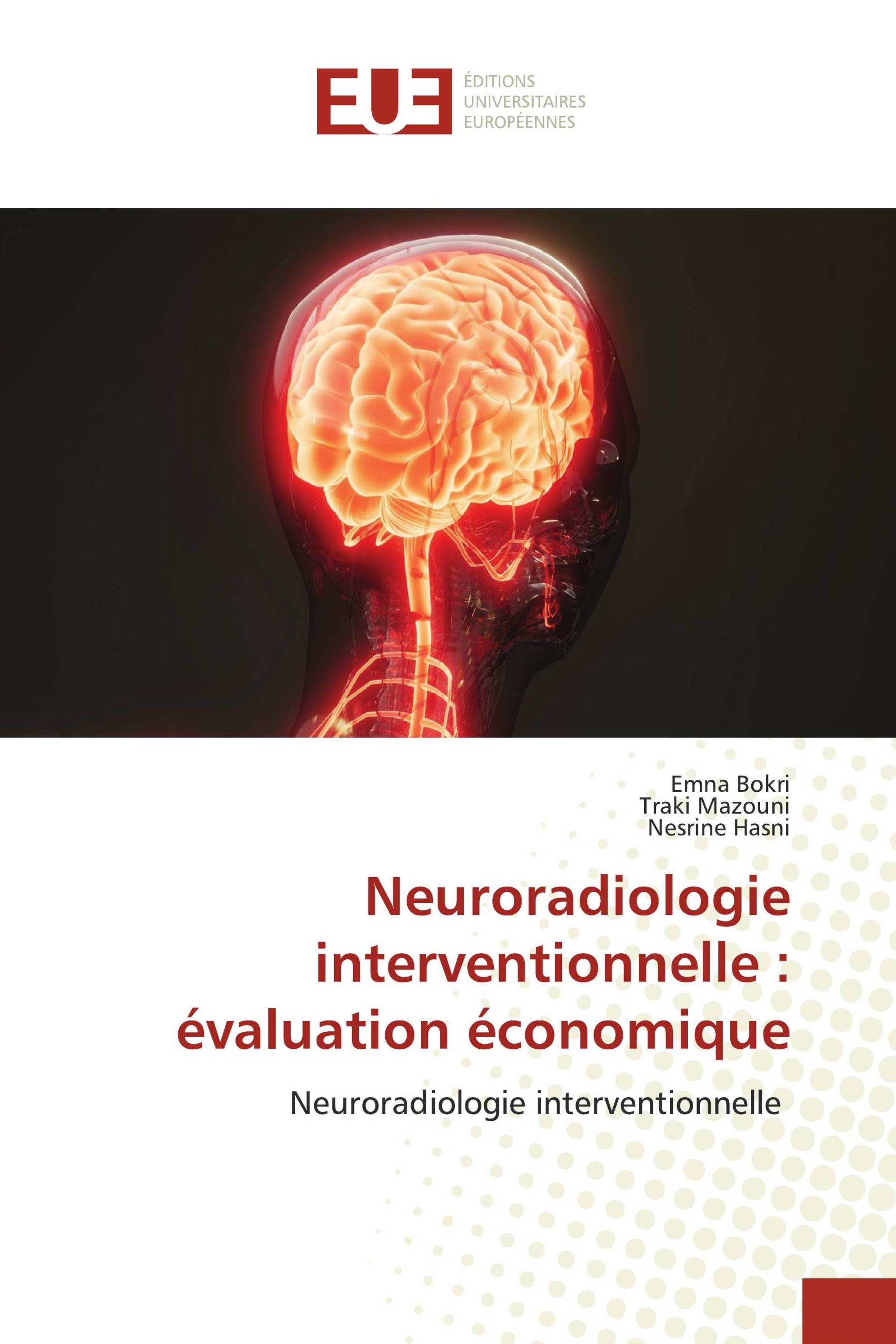 Neuroradiologie interventionnelle : évaluation économique