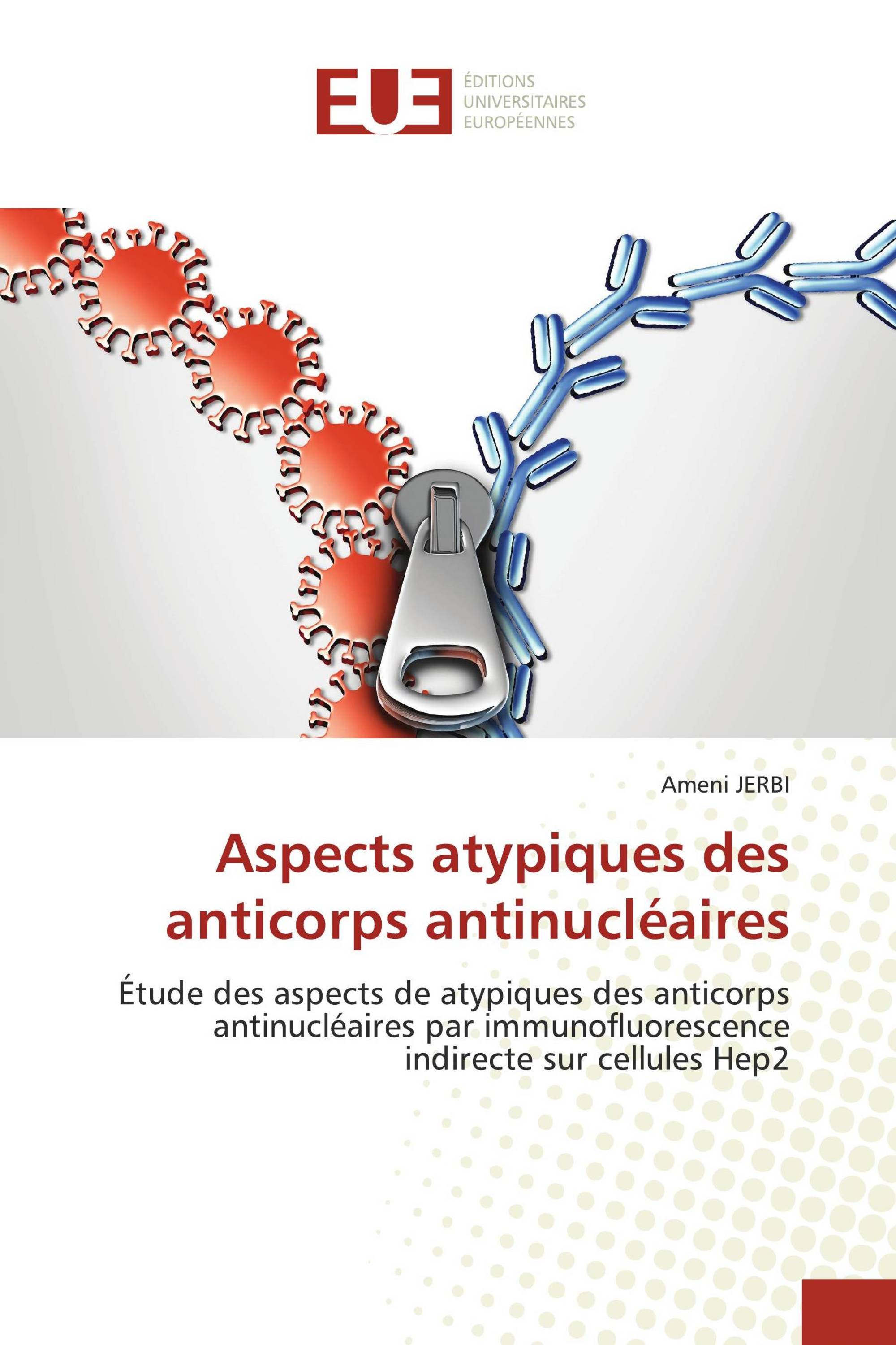 Aspects atypiques des anticorps antinucléaires