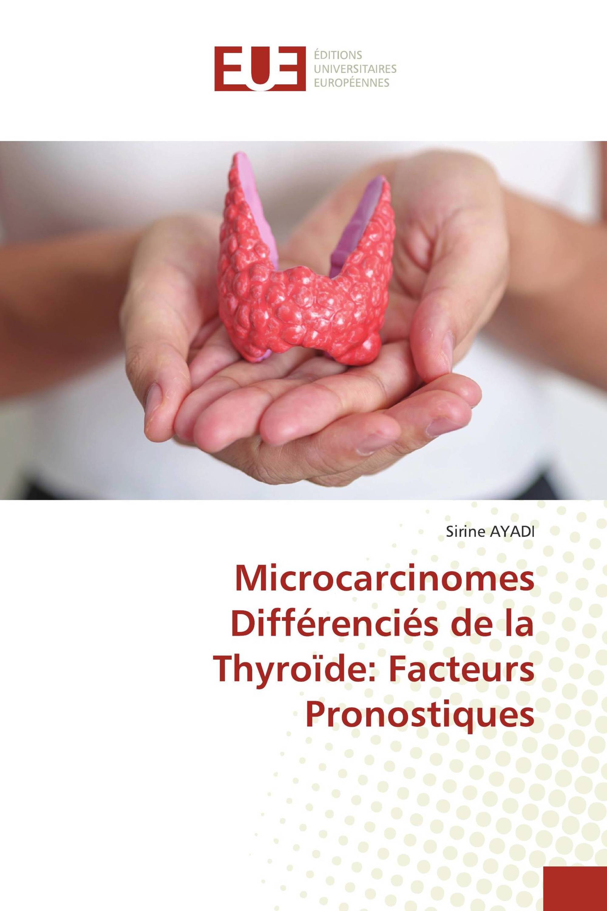 Microcarcinomes Différenciés de la Thyroïde: Facteurs Pronostiques