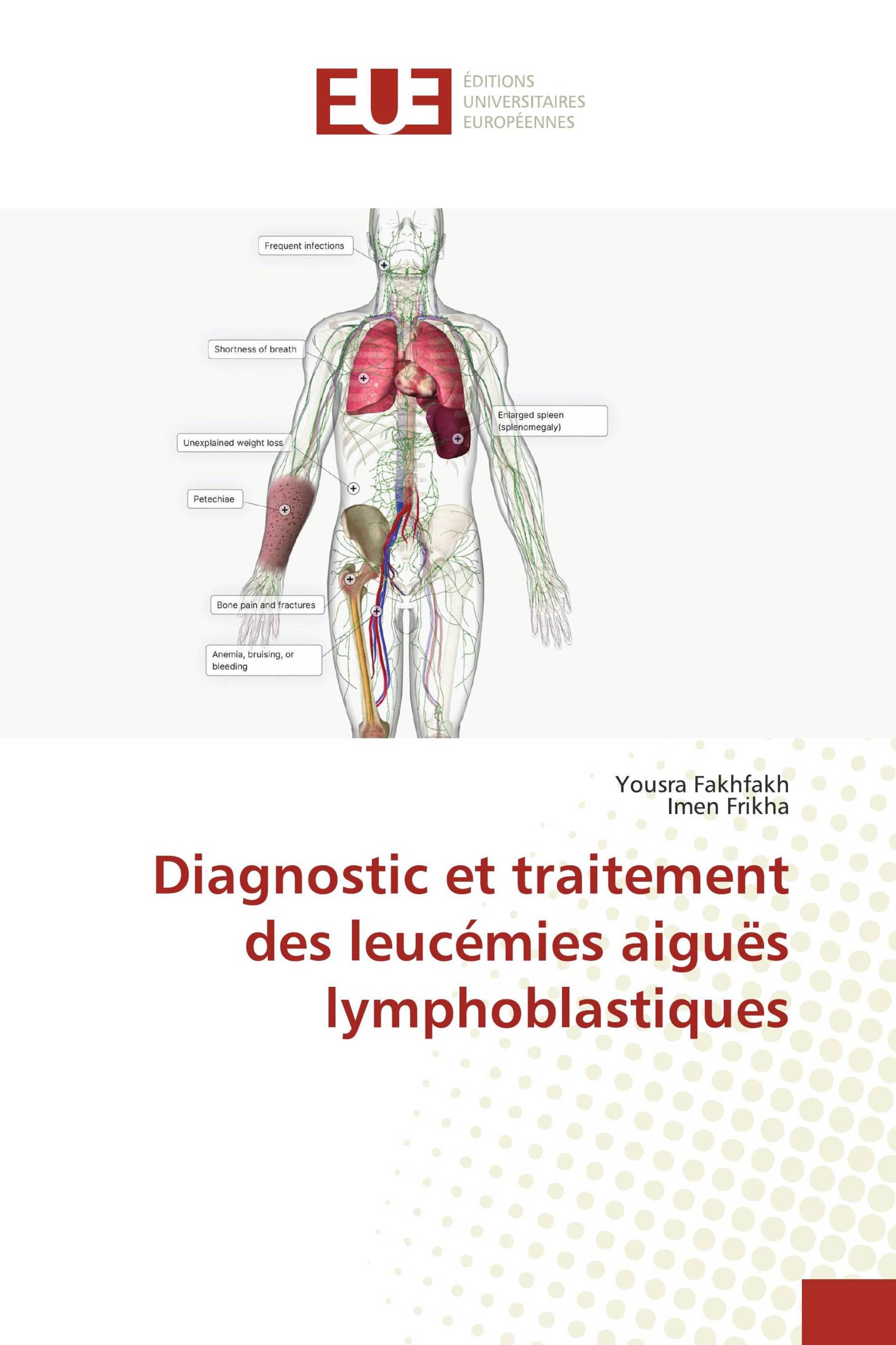 Diagnostic et traitement des leucémies aiguës lymphoblastiques