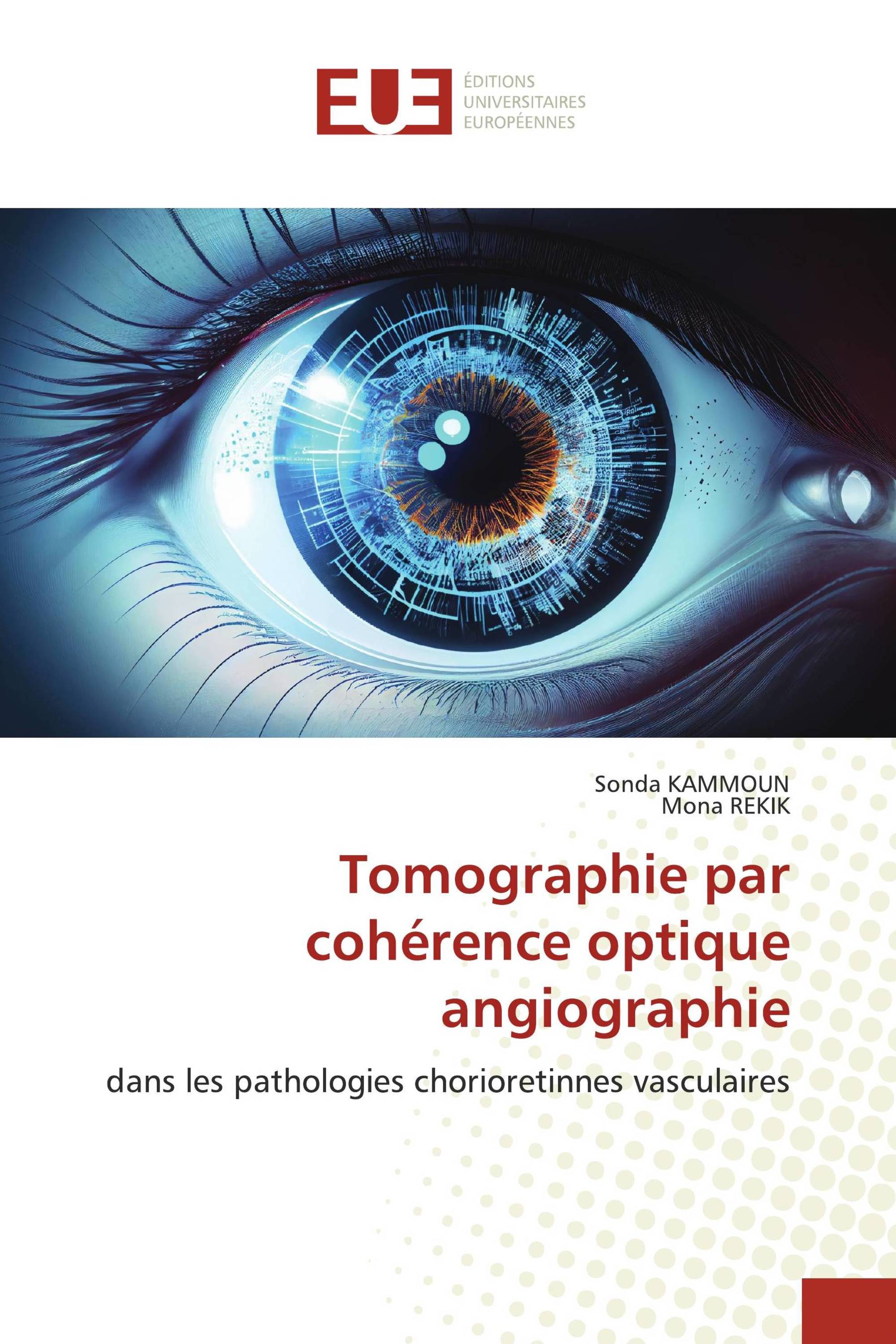 Tomographie par cohérence optique angiographie