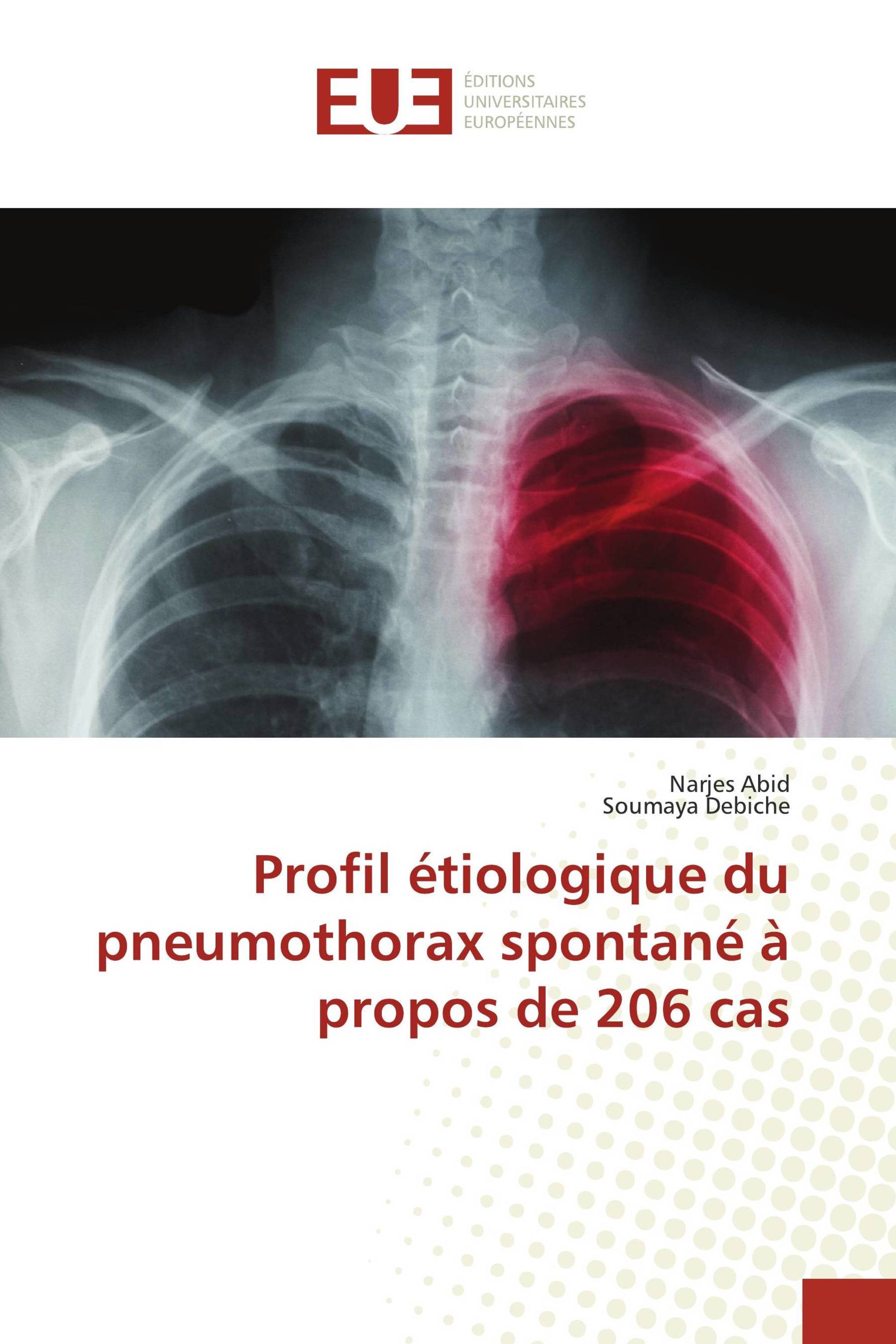 Profil étiologique du pneumothorax spontané à propos de 206 cas