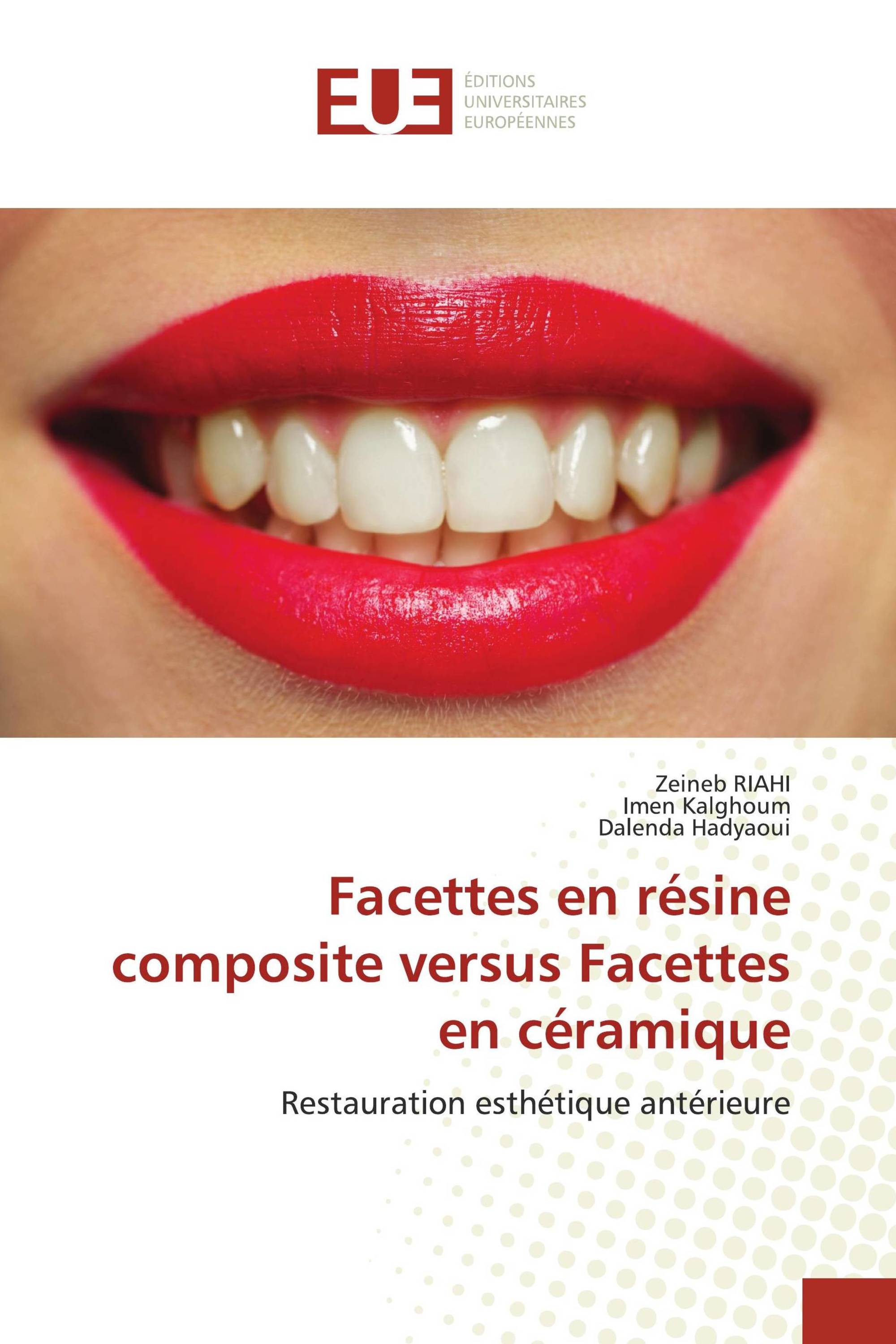 Facettes en résine composite versus Facettes en céramique