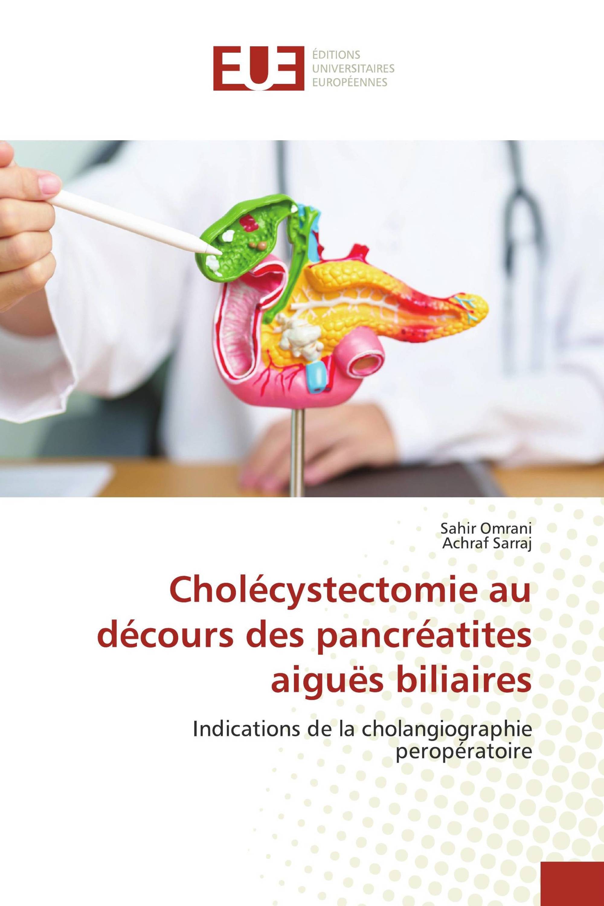 Cholécystectomie au décours des pancréatites aiguës biliaires