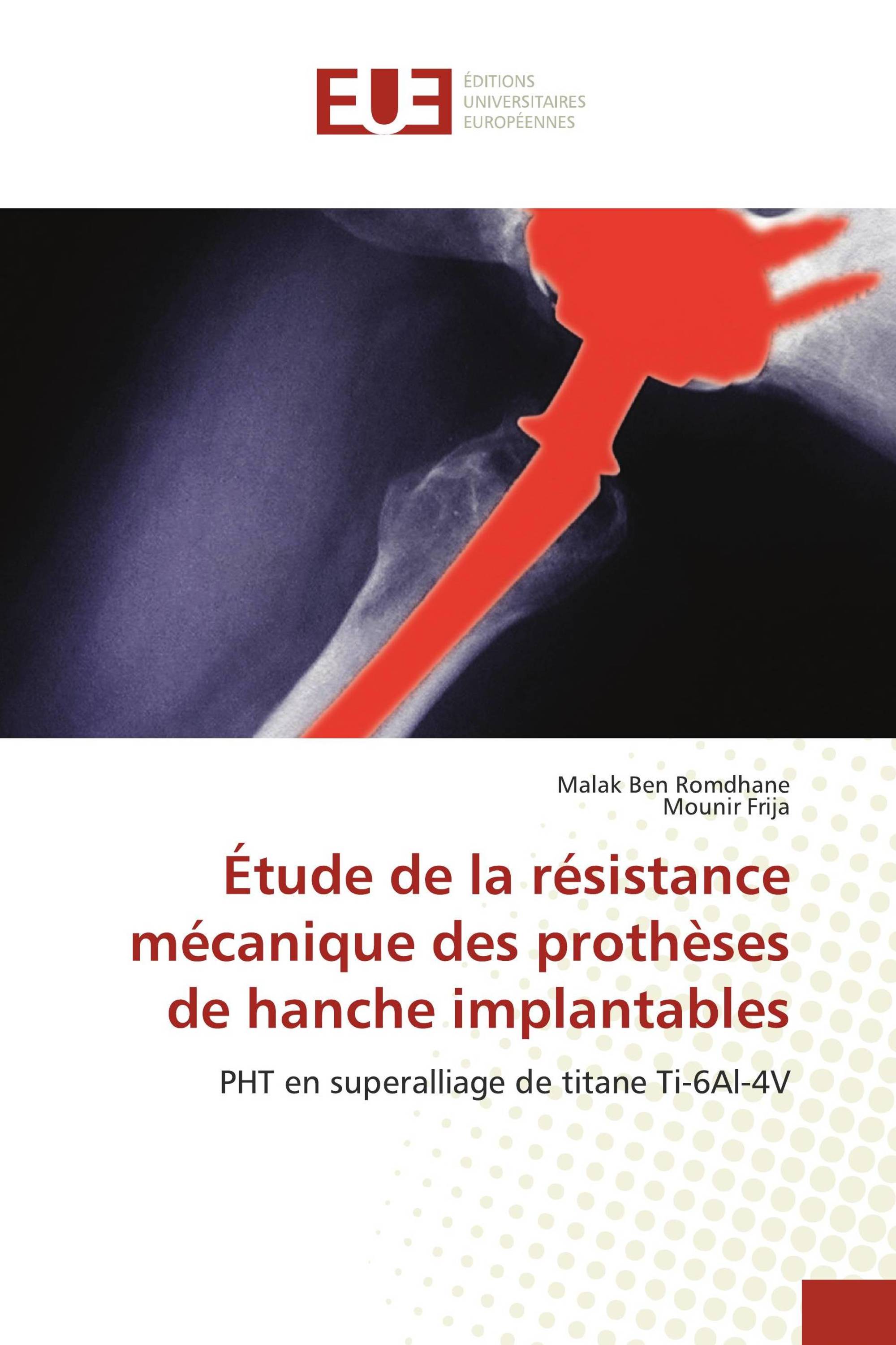 Étude de la résistance mécanique des prothèses de hanche implantables