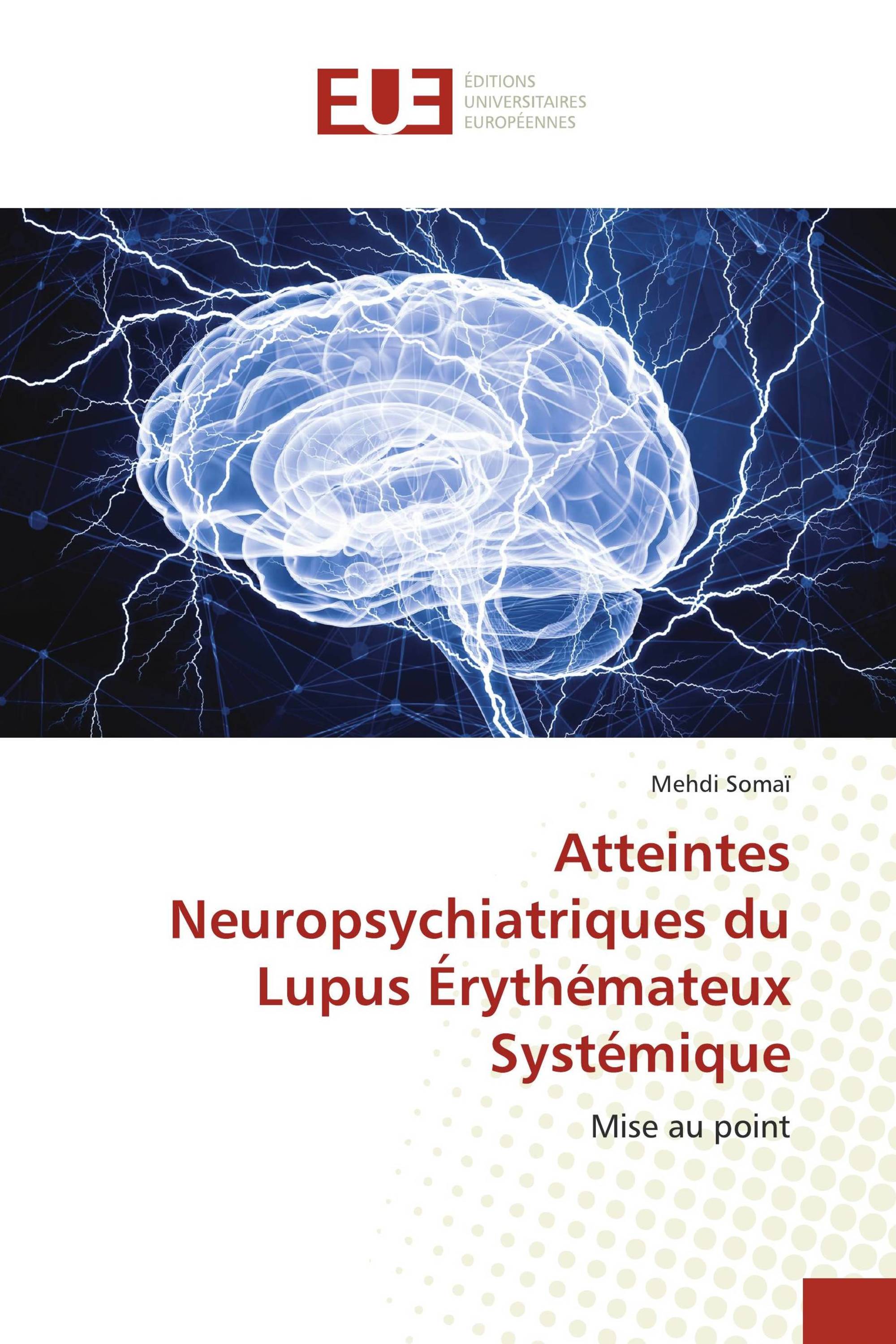 Atteintes Neuropsychiatriques du Lupus Érythémateux Systémique