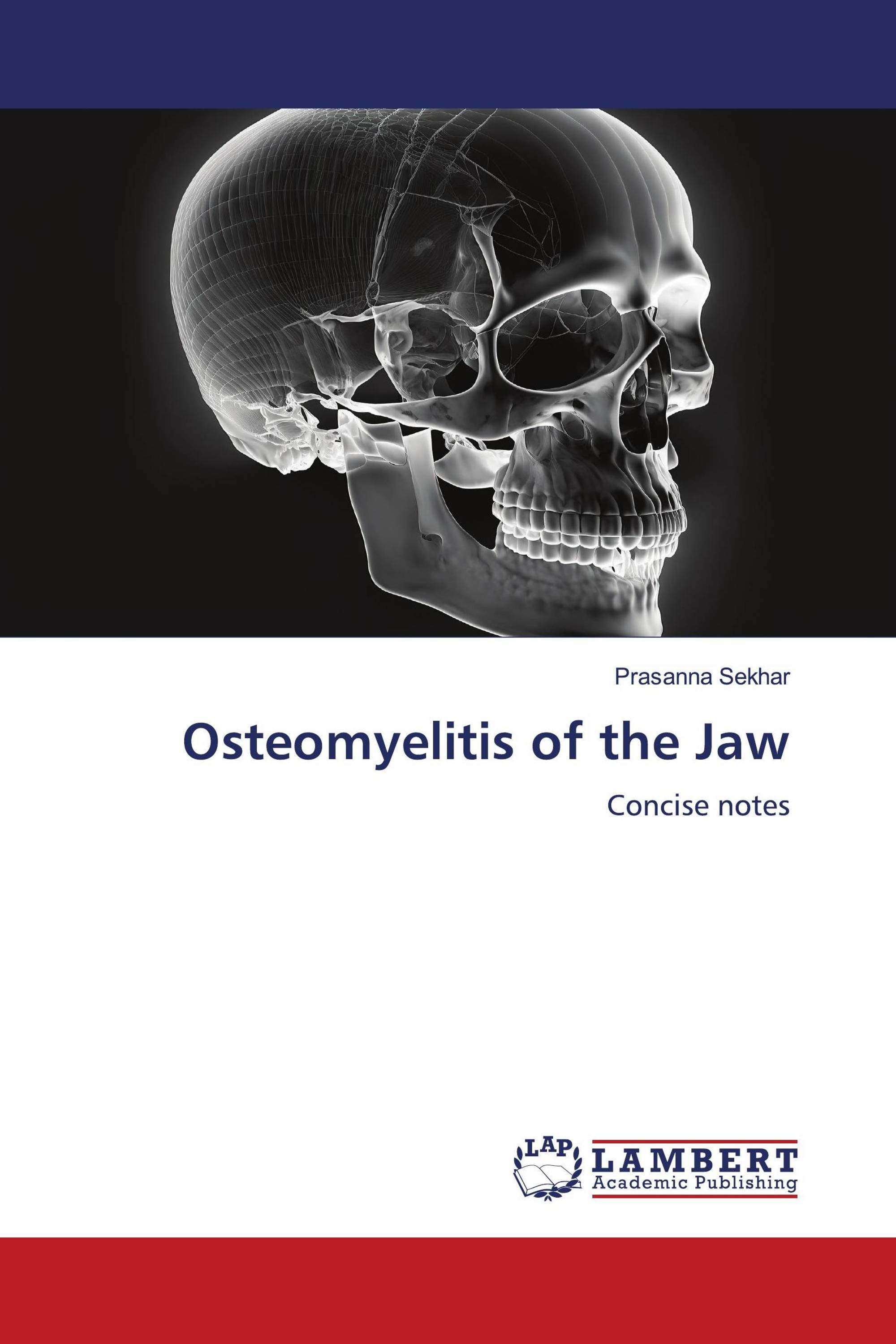 Osteomyelitis of the Jaw / 9786206752240 / 9786206752240 / 6206752240