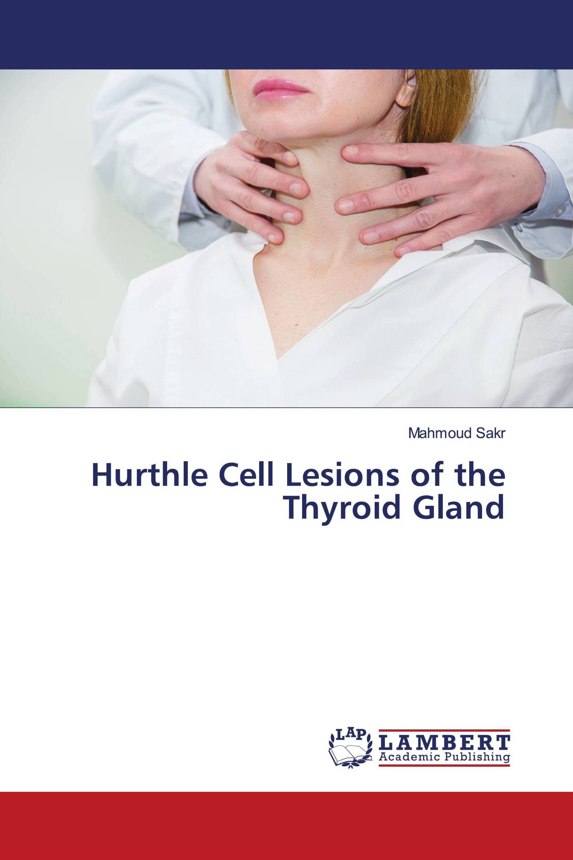 Hurthle Cell Lesions of the Thyroid Gland