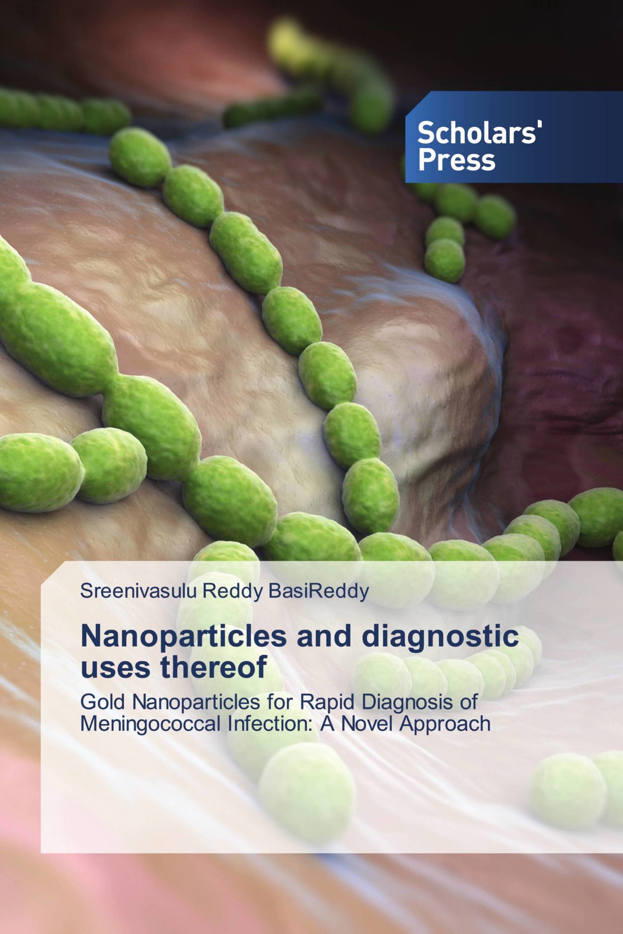 Nanoparticles and diagnostic uses thereof