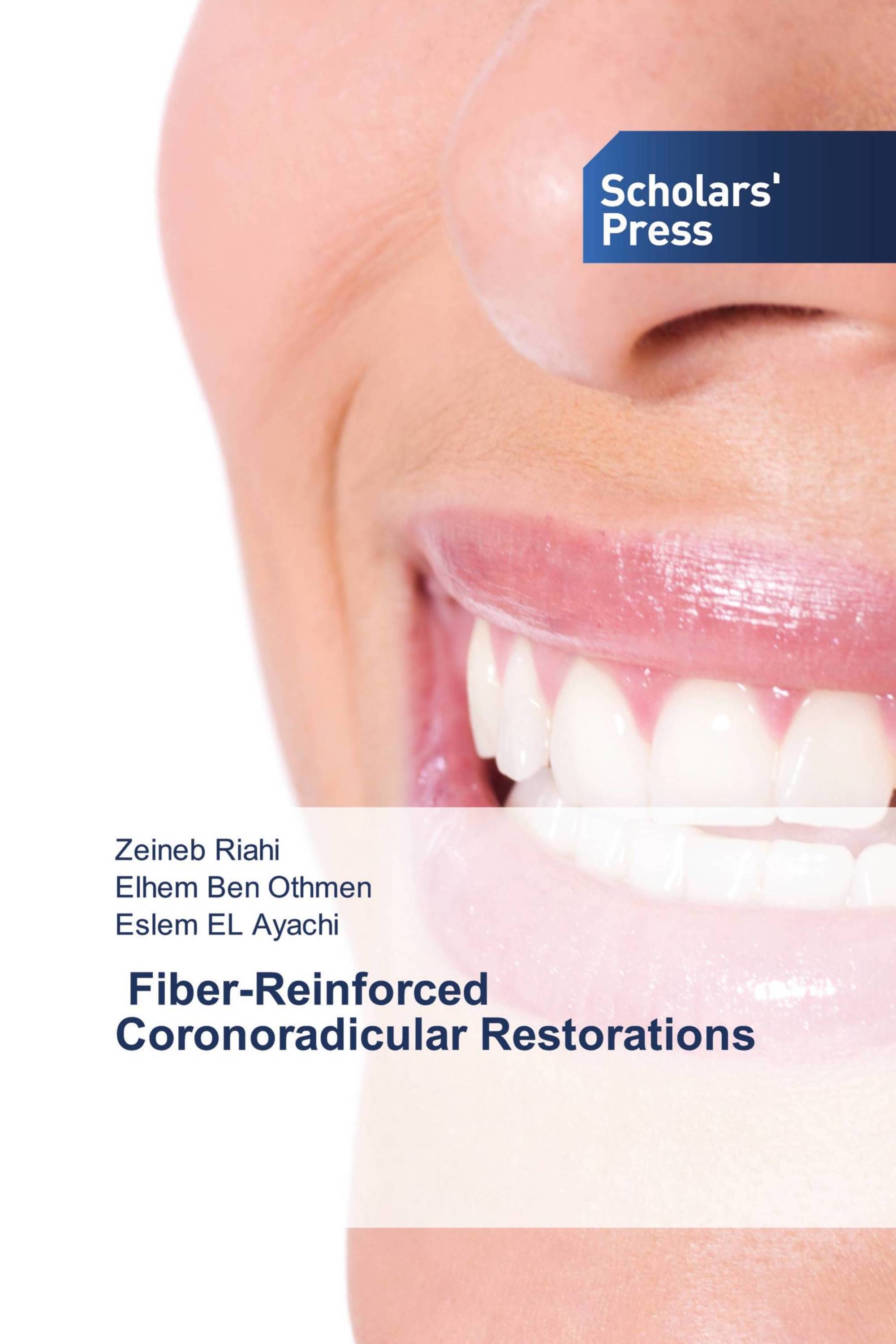 ‎ Fiber-Reinforced Coronoradicular Restorations