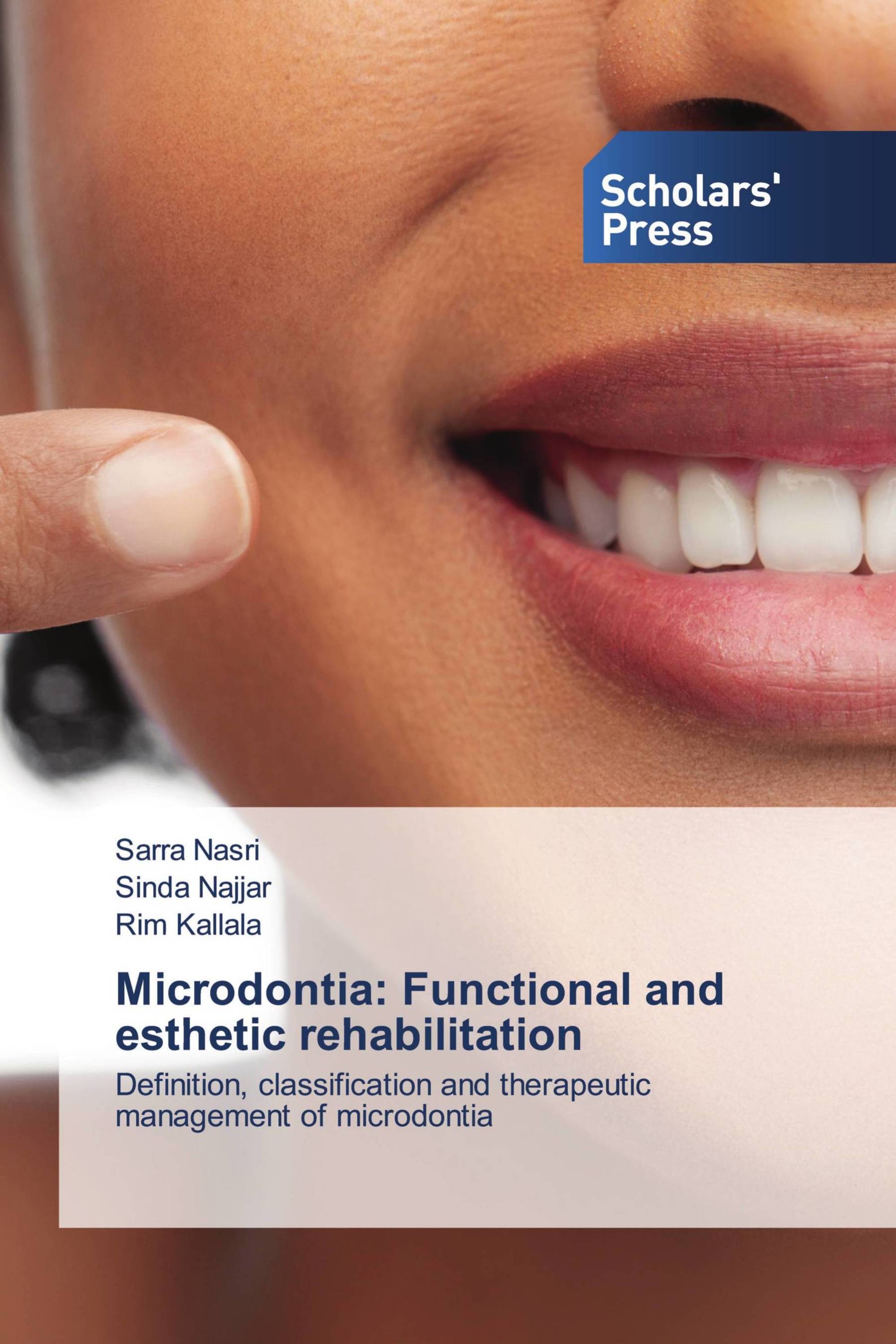 Microdontia: Functional and esthetic rehabilitation