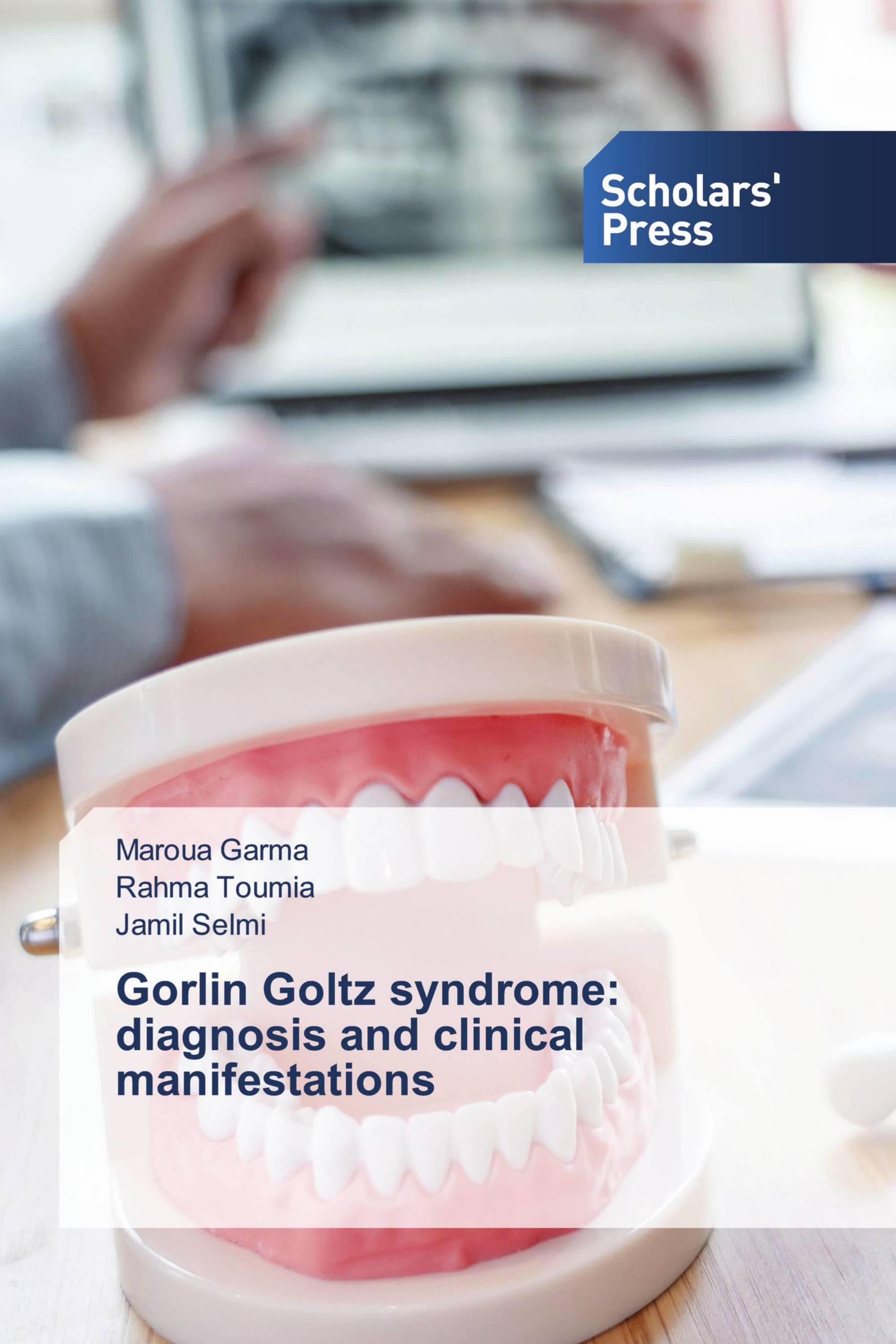 Gorlin Goltz syndrome: diagnosis and clinical manifestations