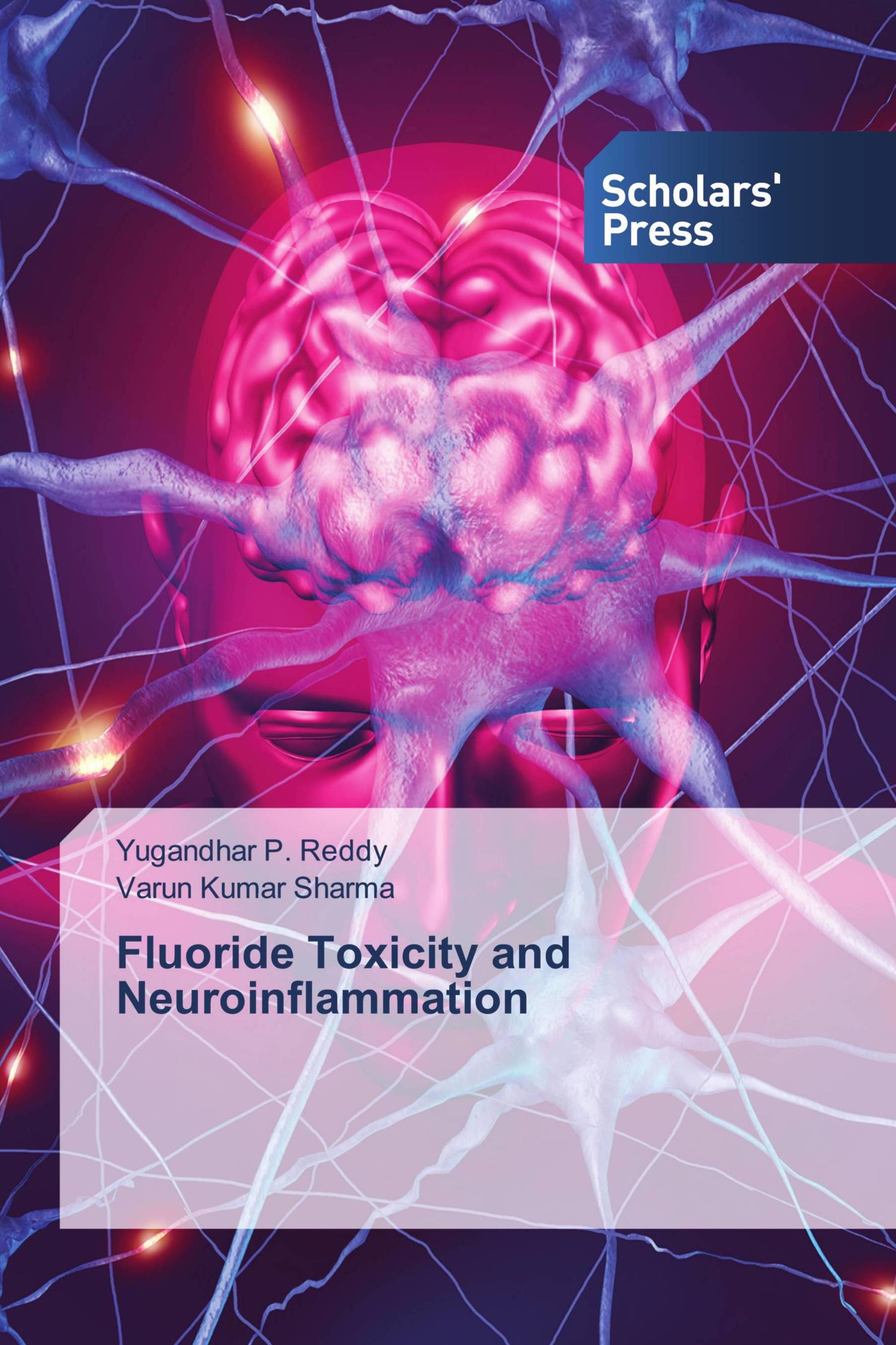 Fluoride Toxicity and Neuroinflammation