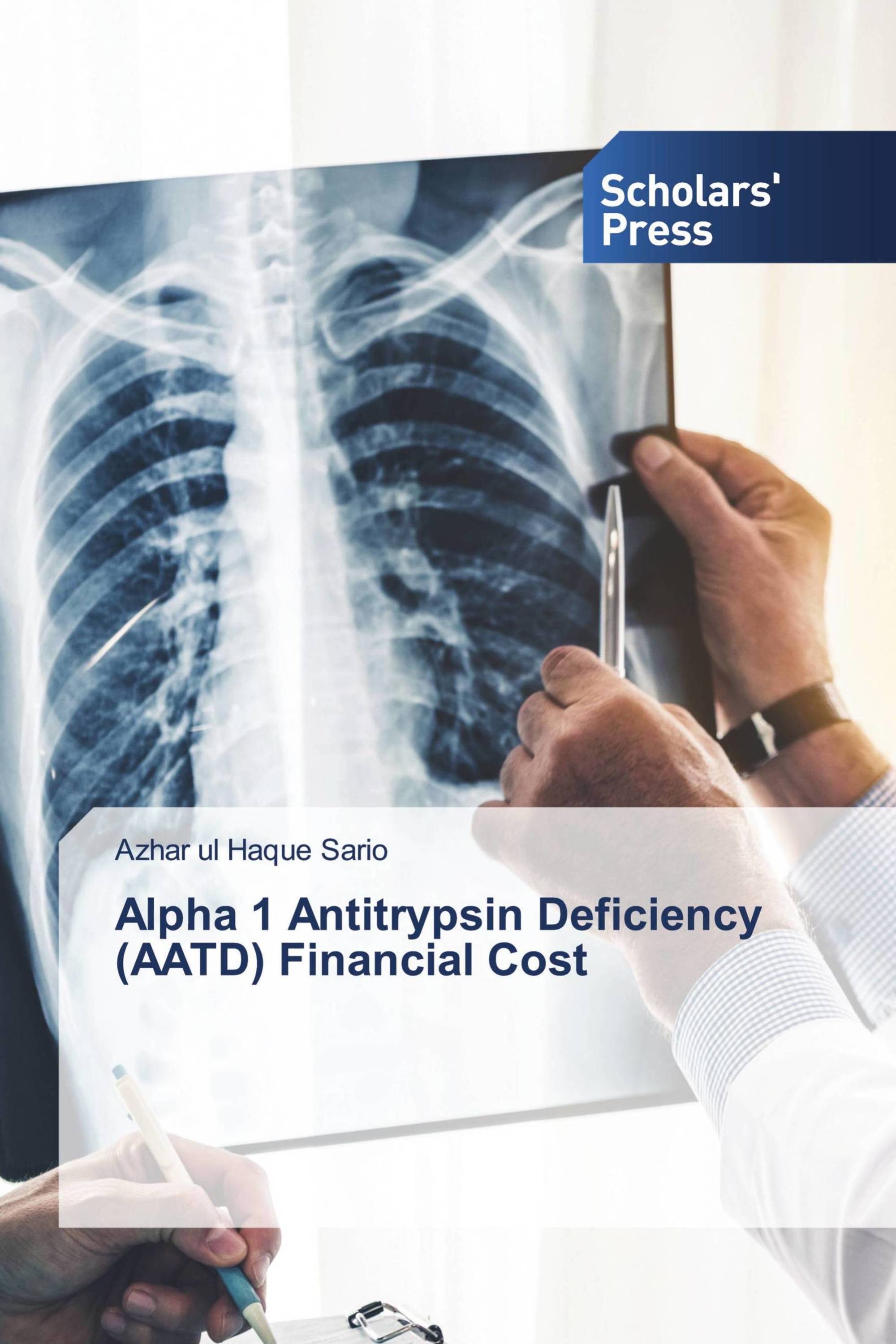 Alpha 1 Antitrypsin Deficiency (AATD) Financial Cost