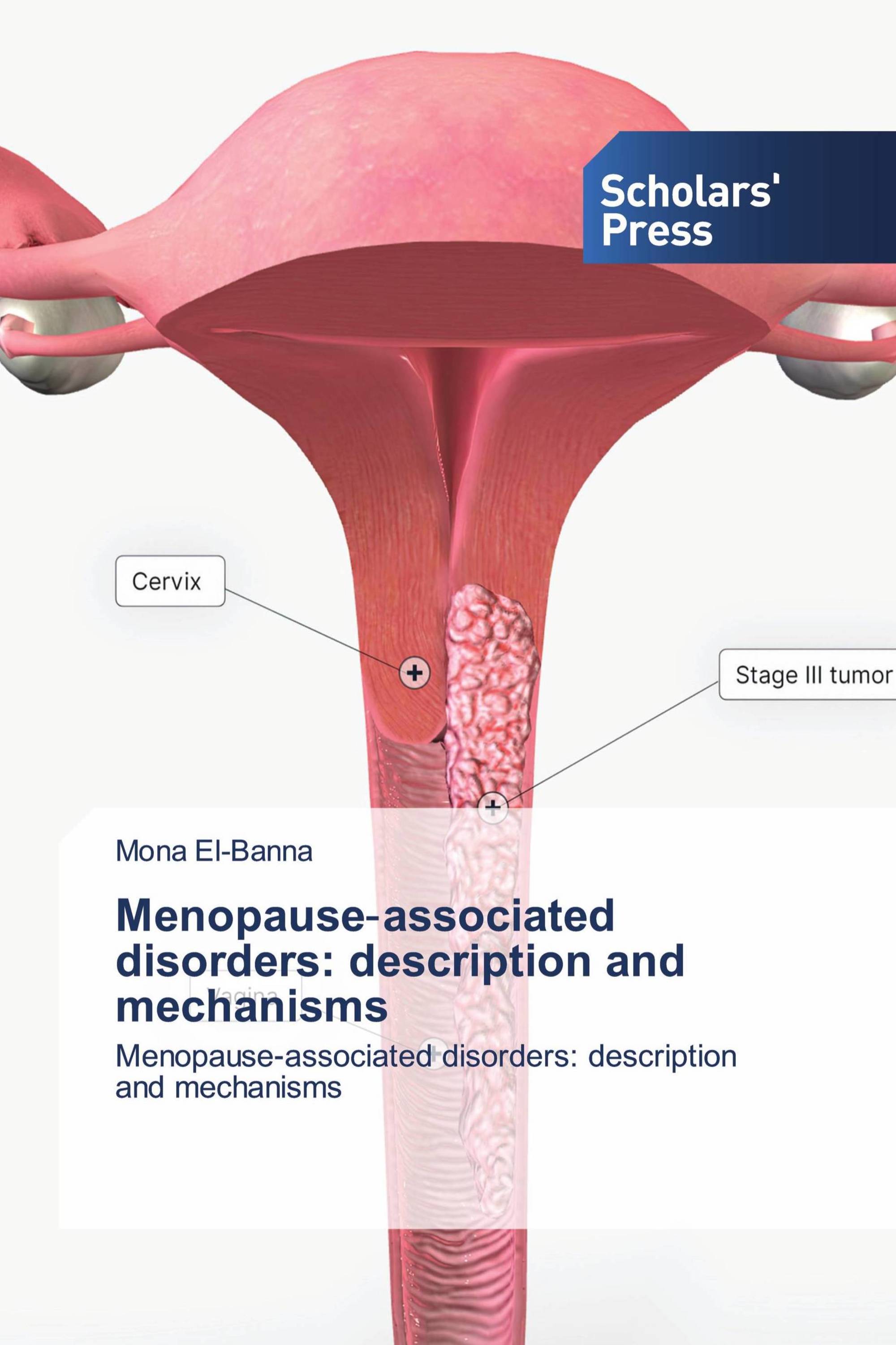 Menopause‐associated disorders: description and mechanisms