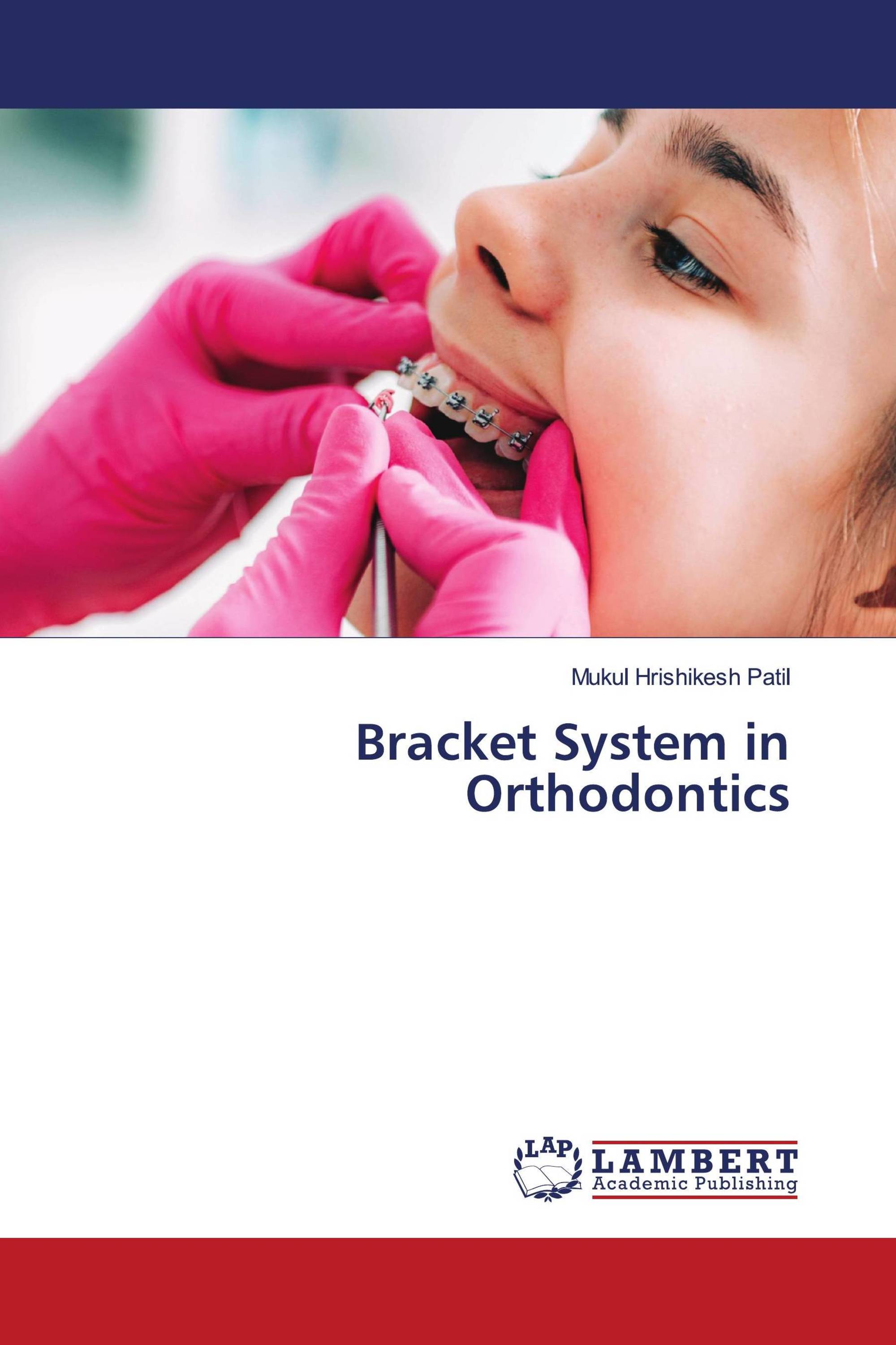 Bracket System in Orthodontics