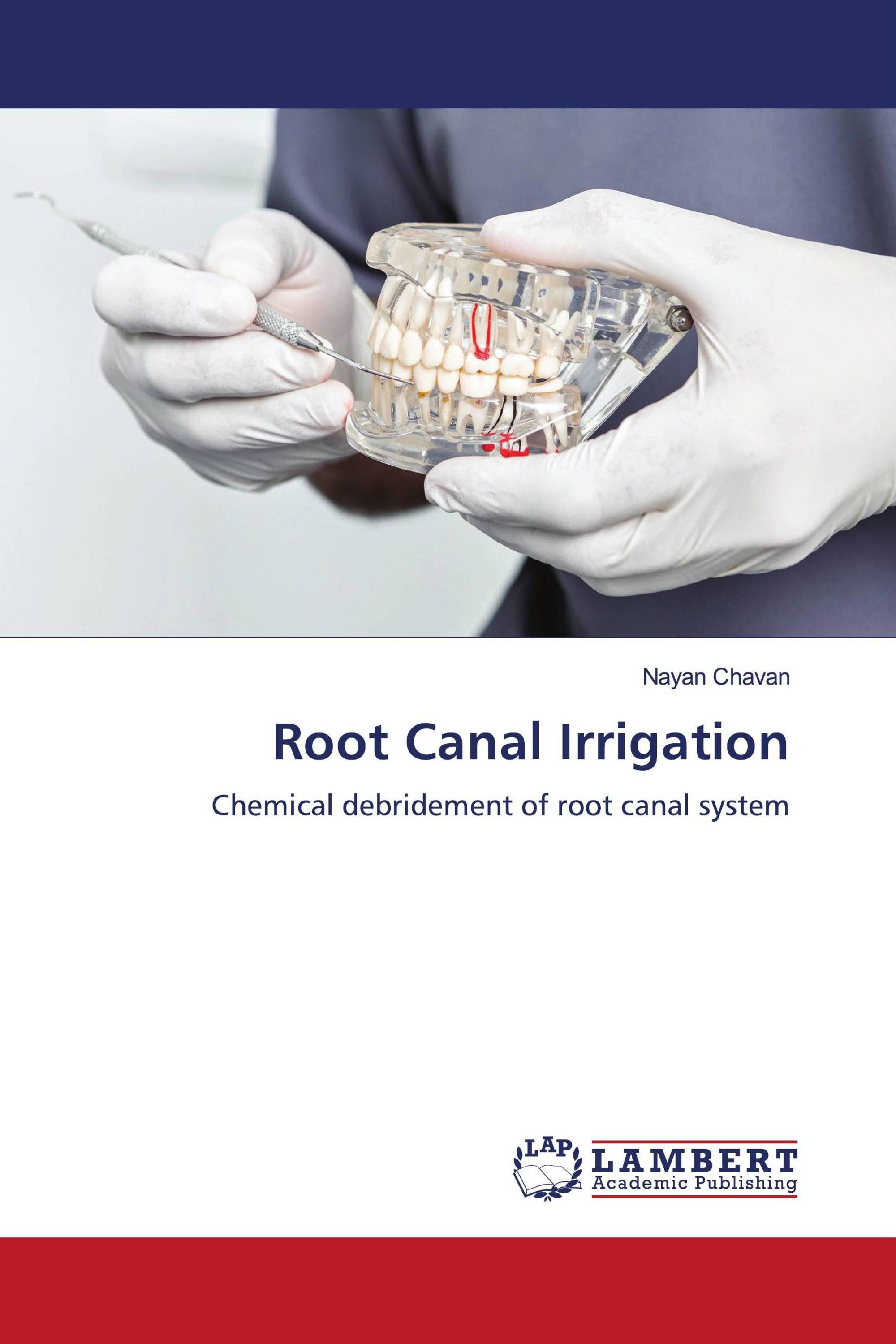 Root Canal Irrigation / 9786206788096 / 9786206788096 / 6206788091