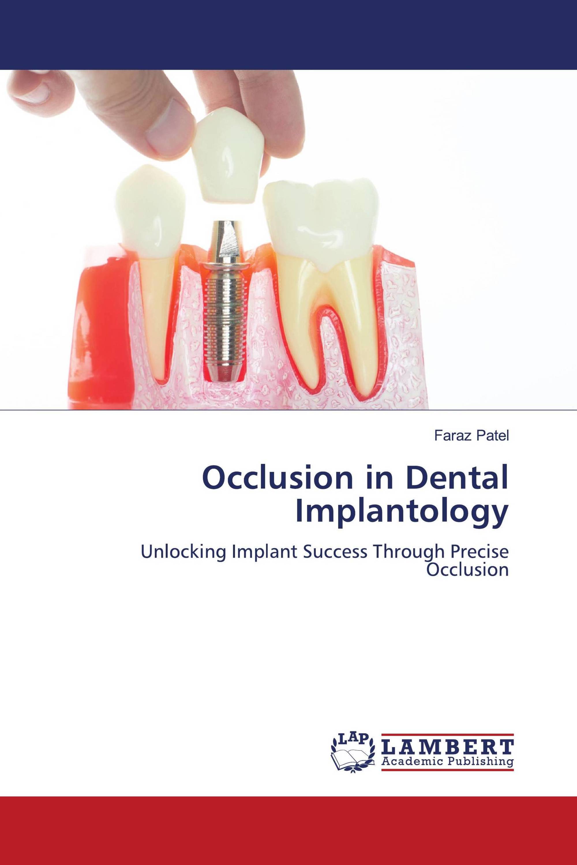 Occlusion in Dental Implantology / 9786206791317 / 9786206791317