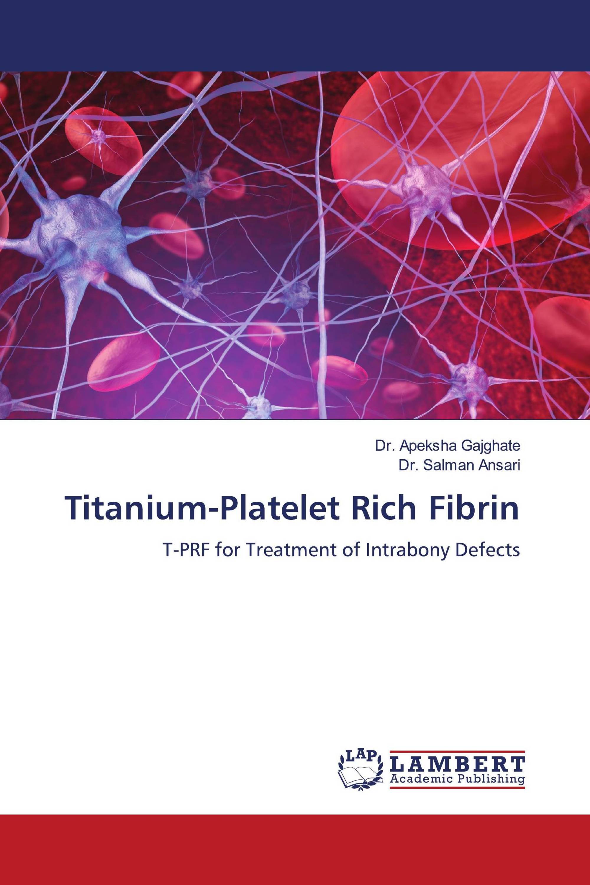 Titanium-Platelet Rich Fibrin